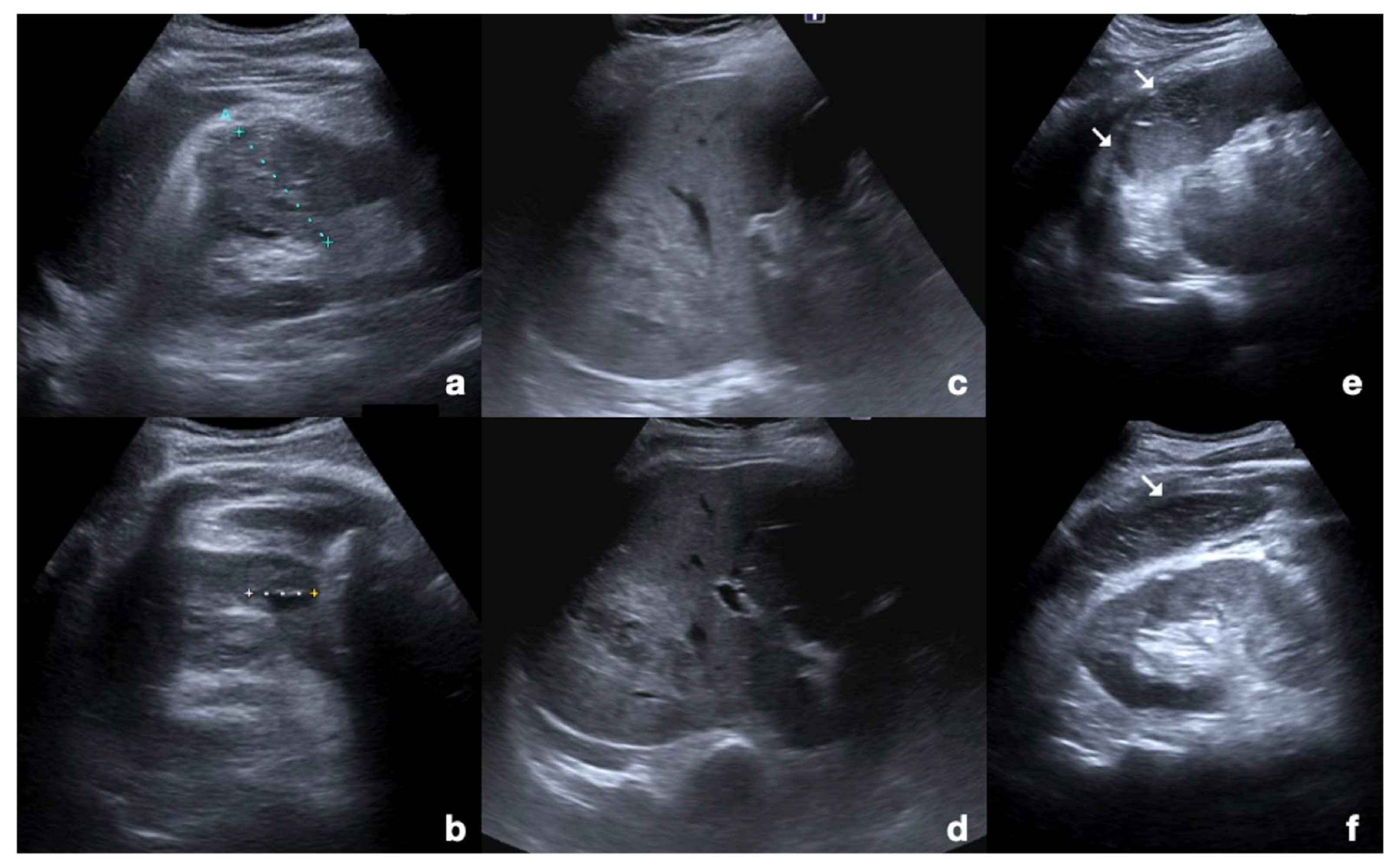 Diagnostics 12 00435 g001