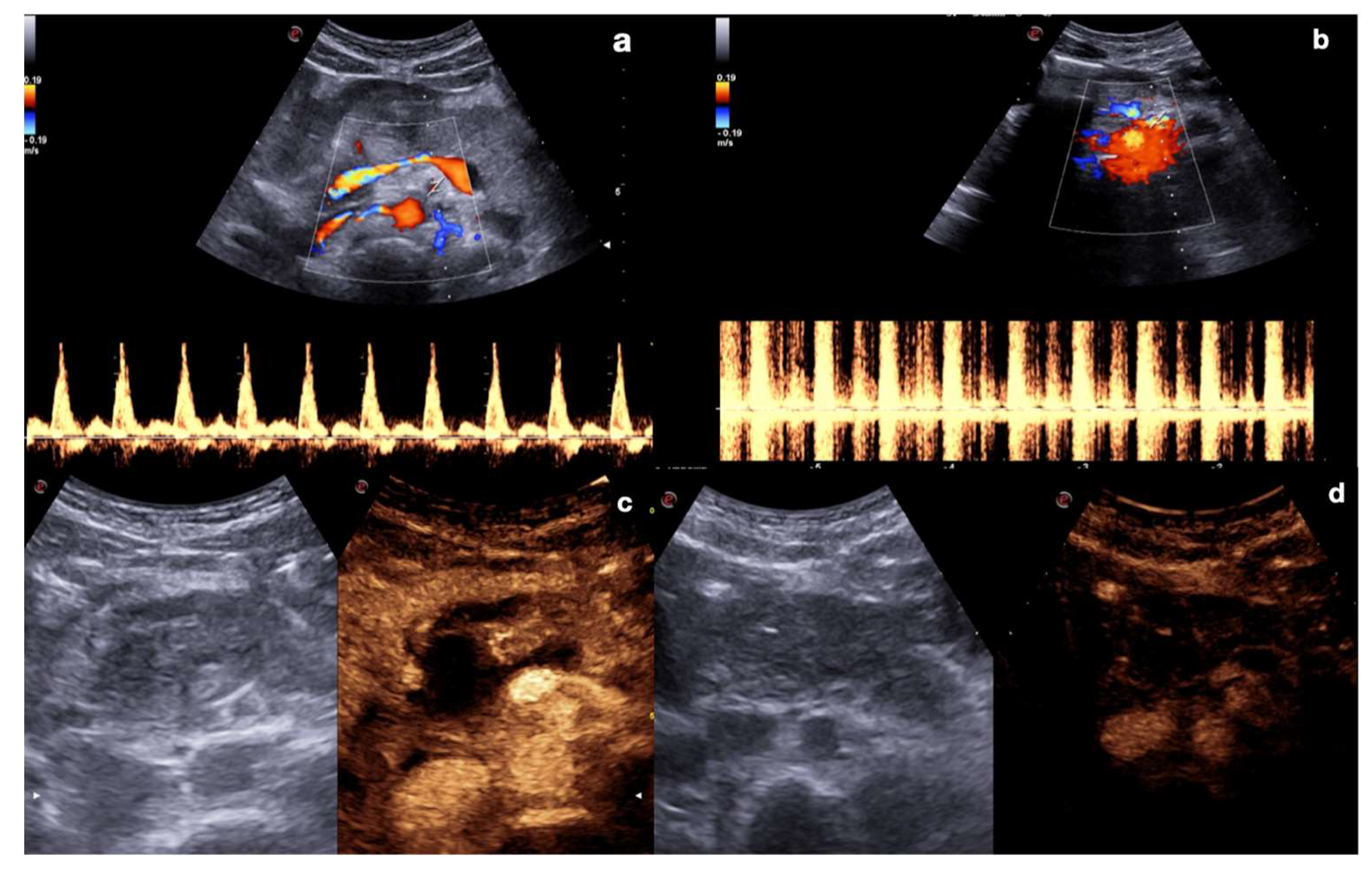 Diagnostics 12 00435 g003
