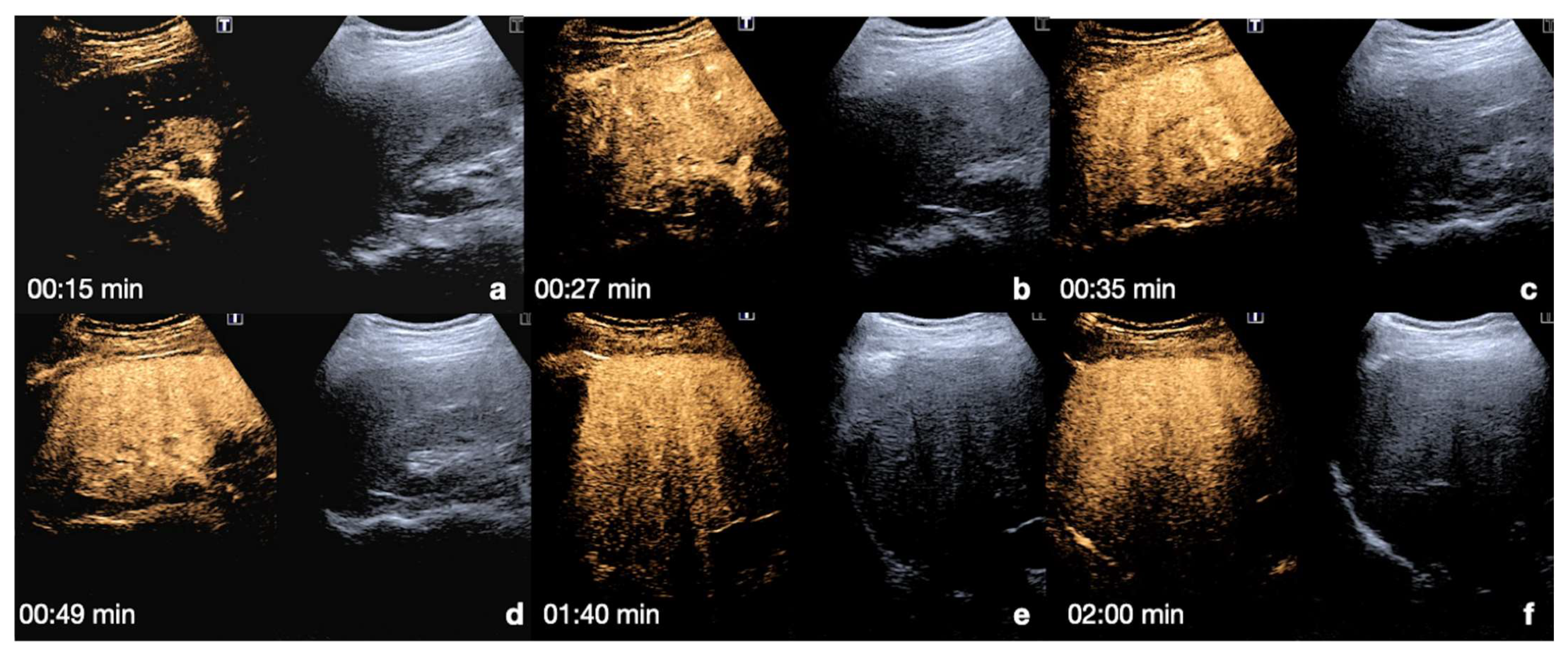 Diagnostics 12 00435 g005