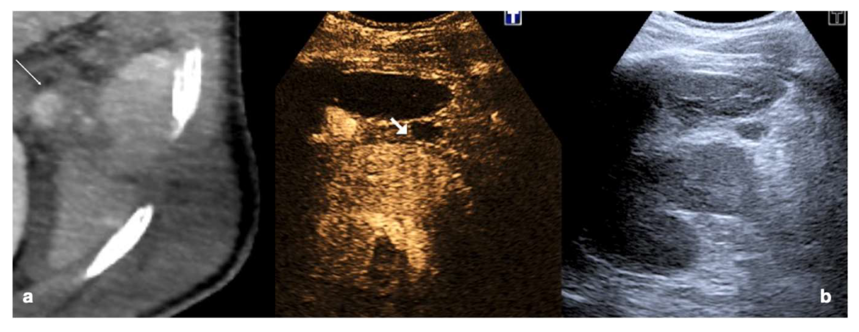 Diagnostics 12 00435 g018