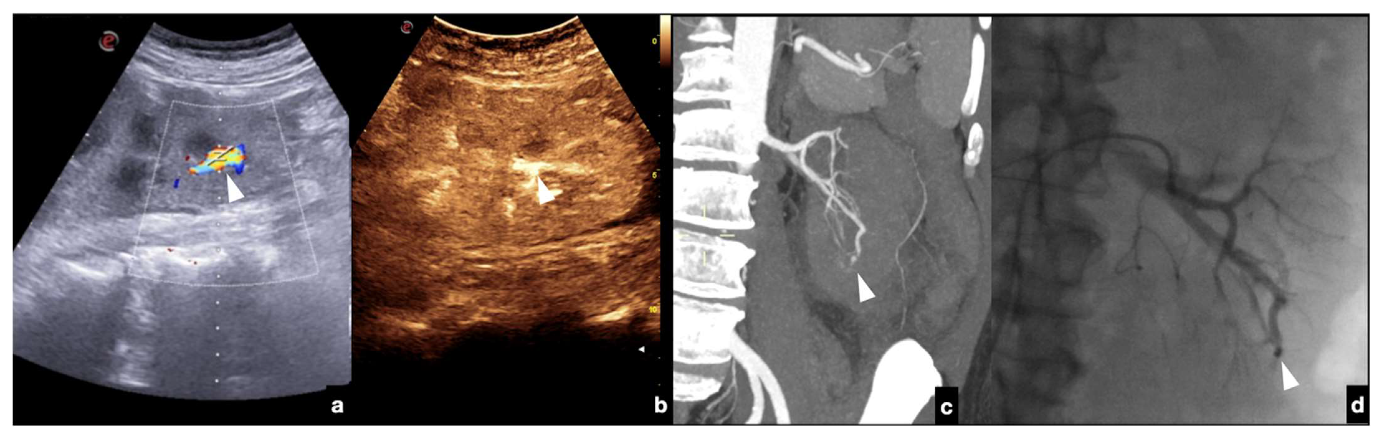 Diagnostics 12 00435 g021