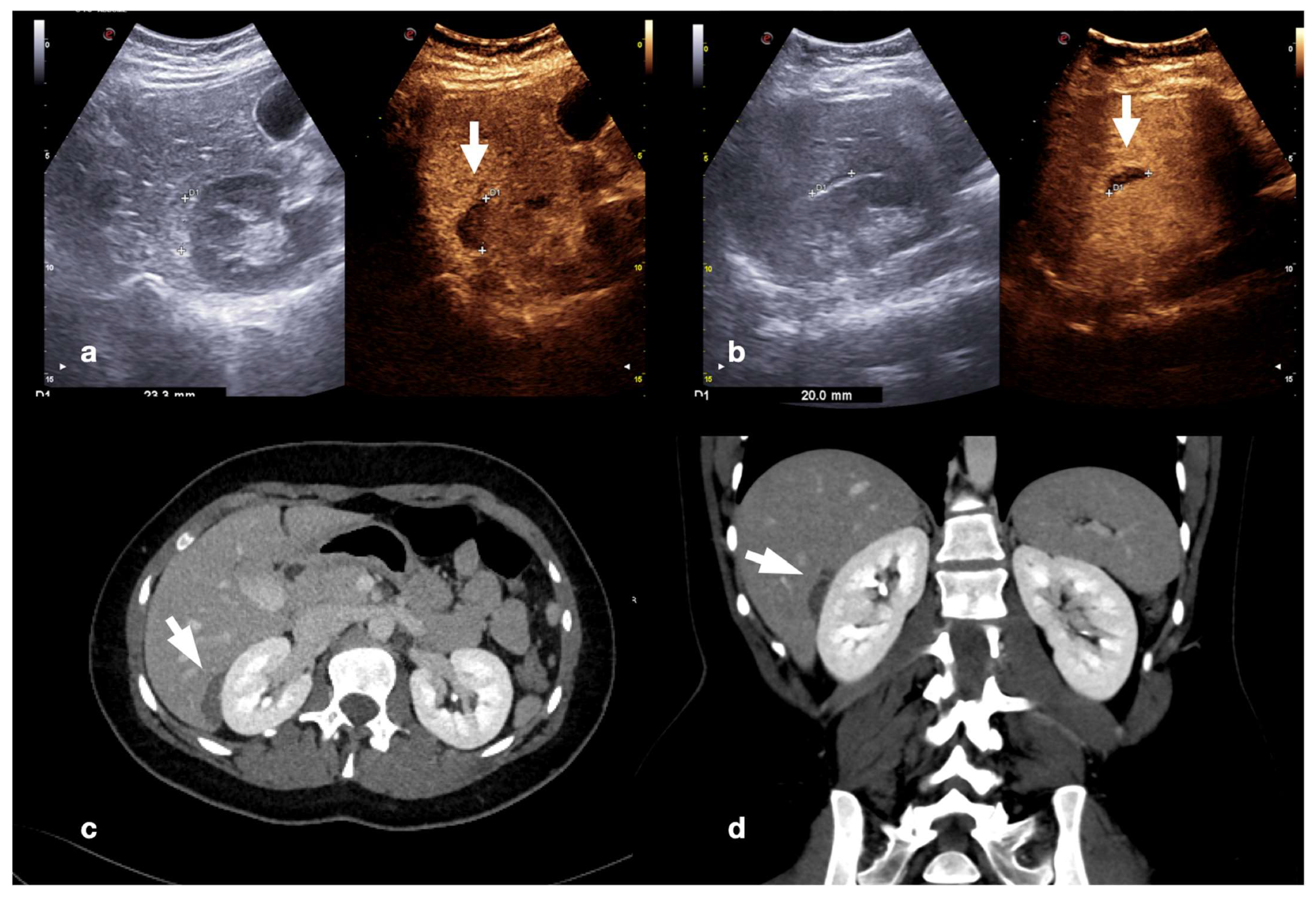 Diagnostics 12 00435 g023