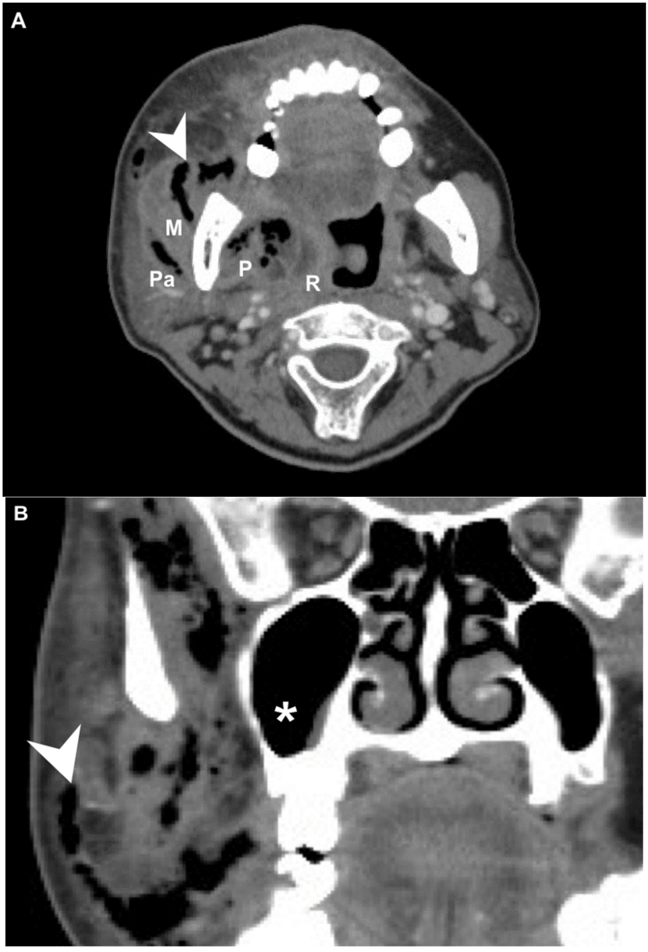 Diagnostics 12 00443 g001 Diagnostics 12 00443 g001