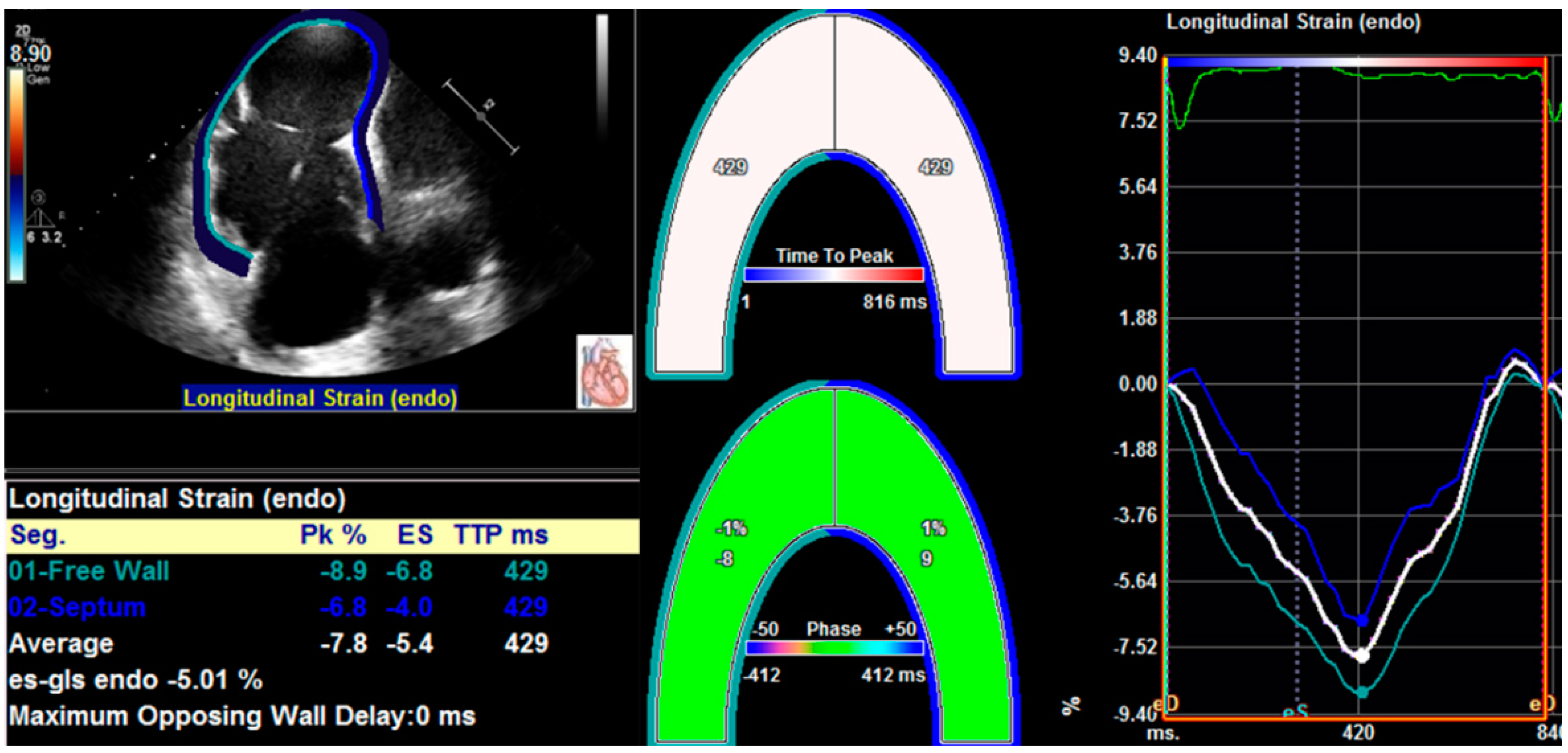 tray air Postman Diagnostics | Free Full-Text | Right Ventricular Longitudinal Strain in  Patients with Heart Failure