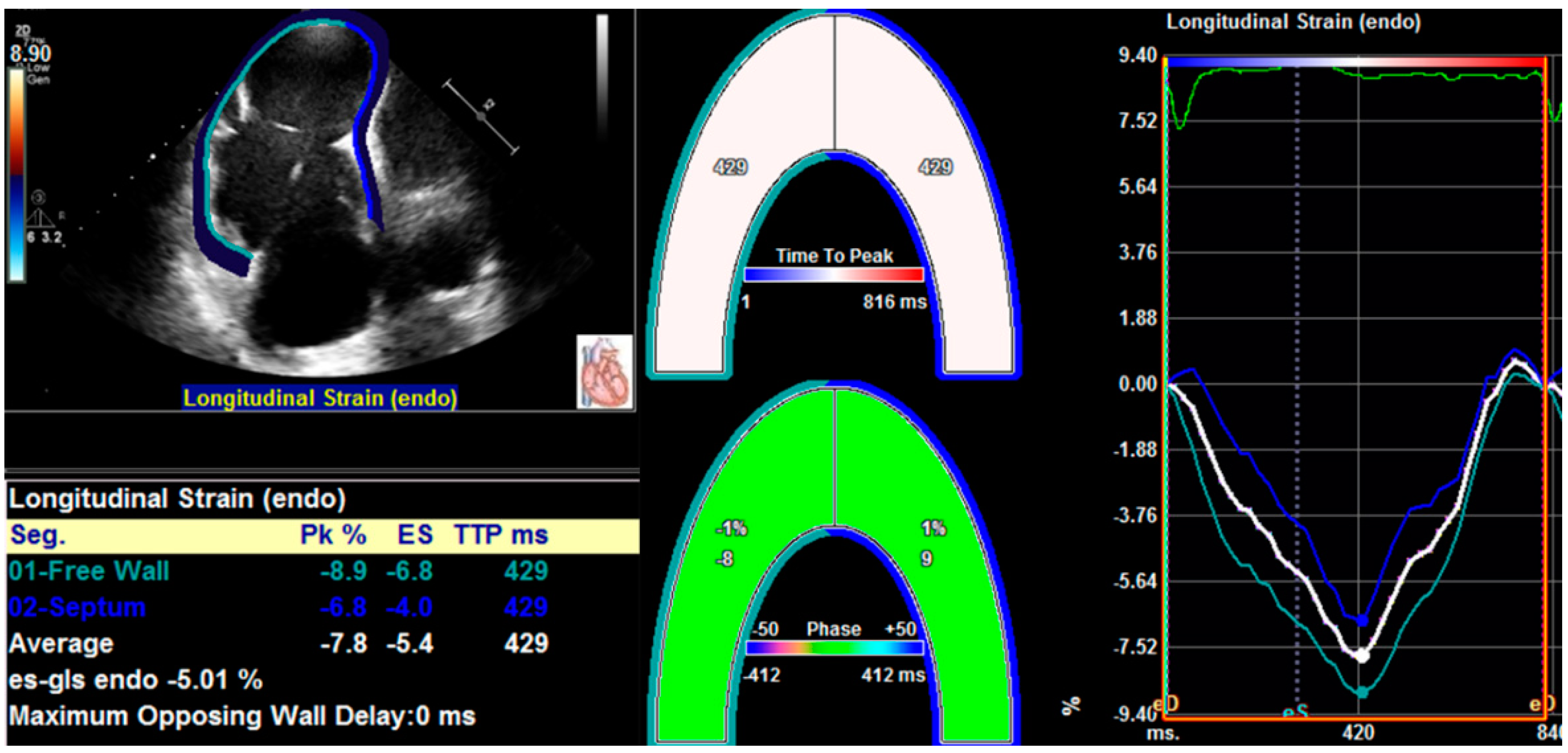 lv strain echo