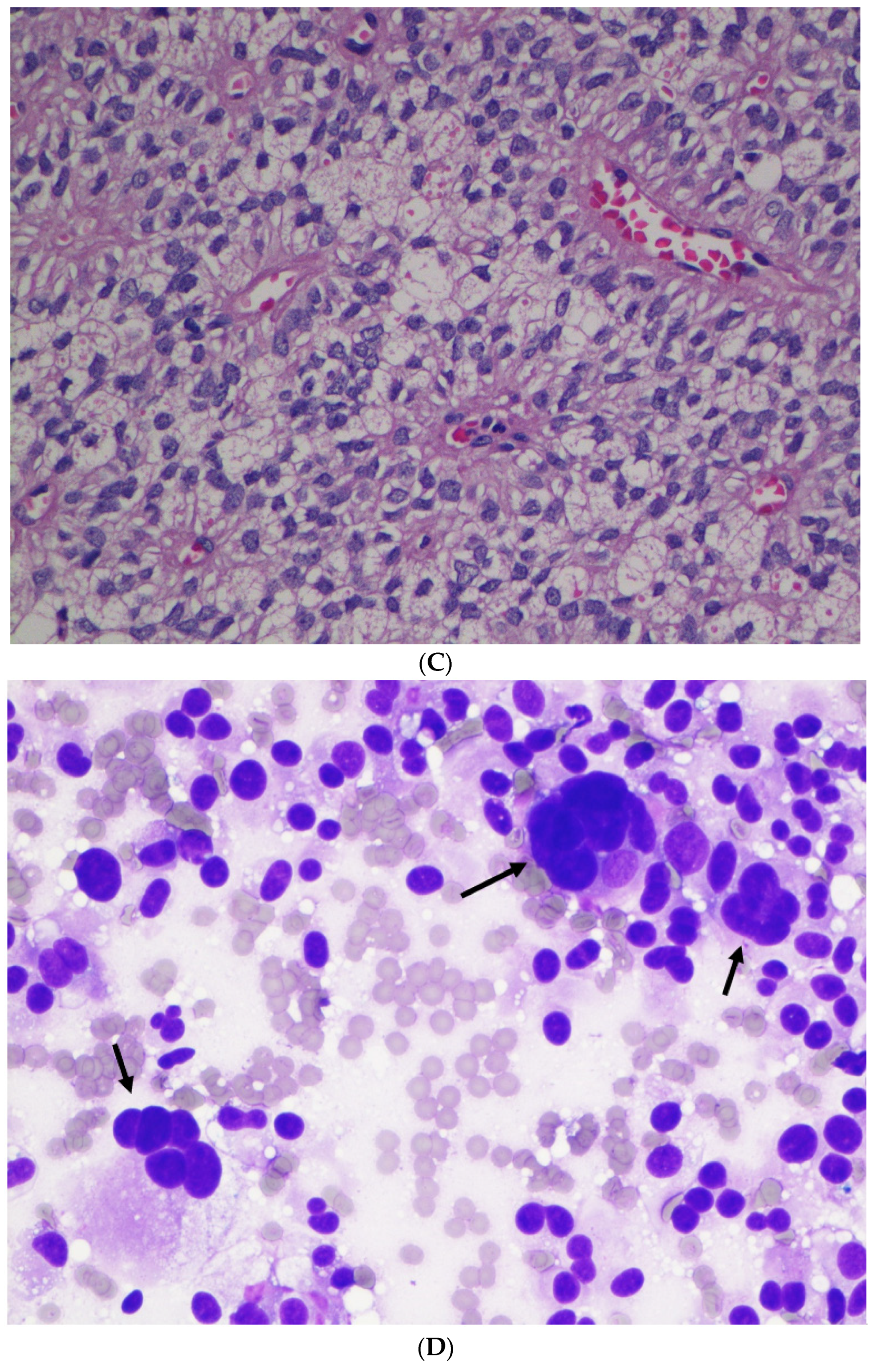 Diagnostics 12 00449 g002b 550