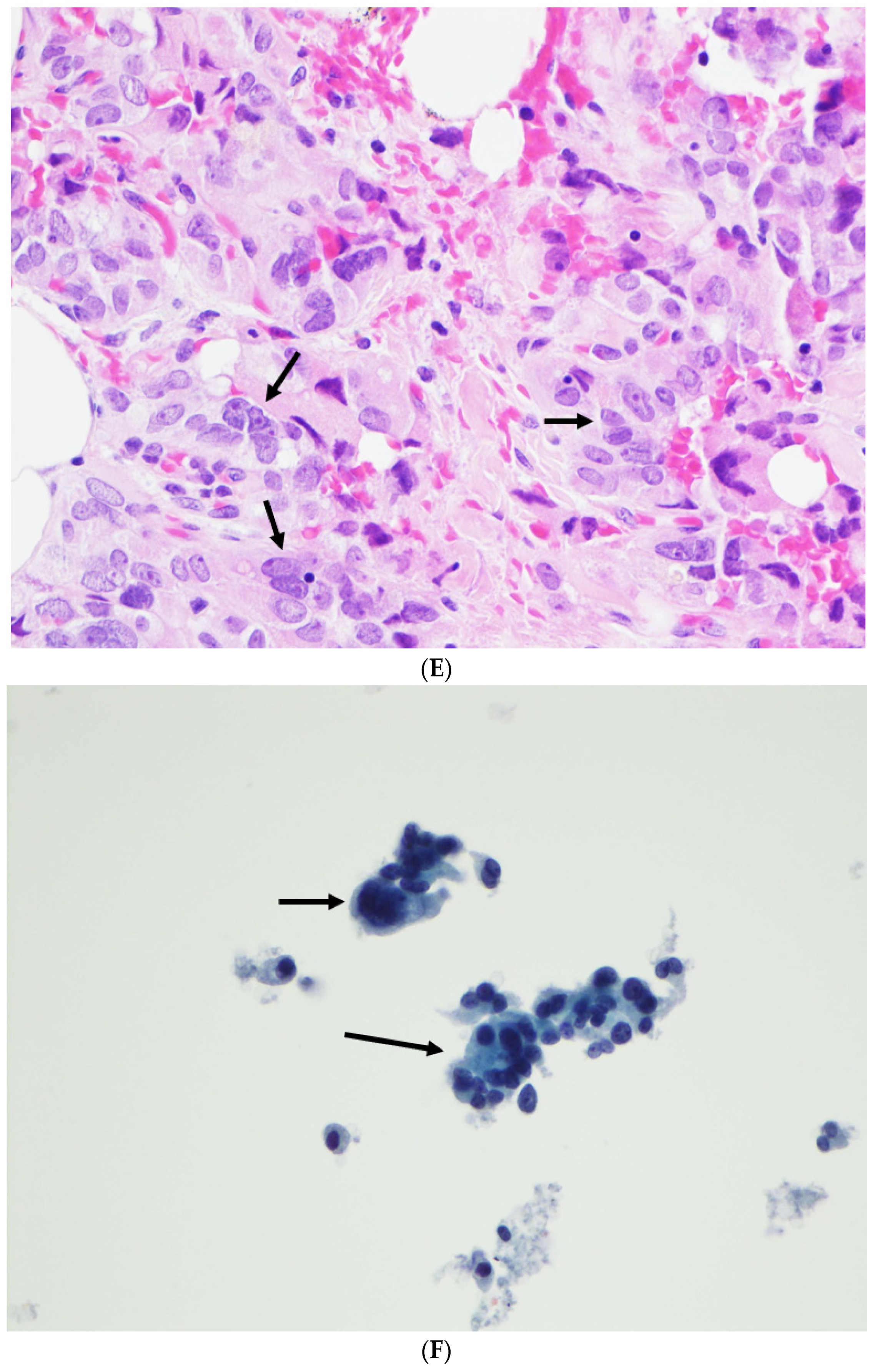 Diagnostics 12 00449 g002c 550