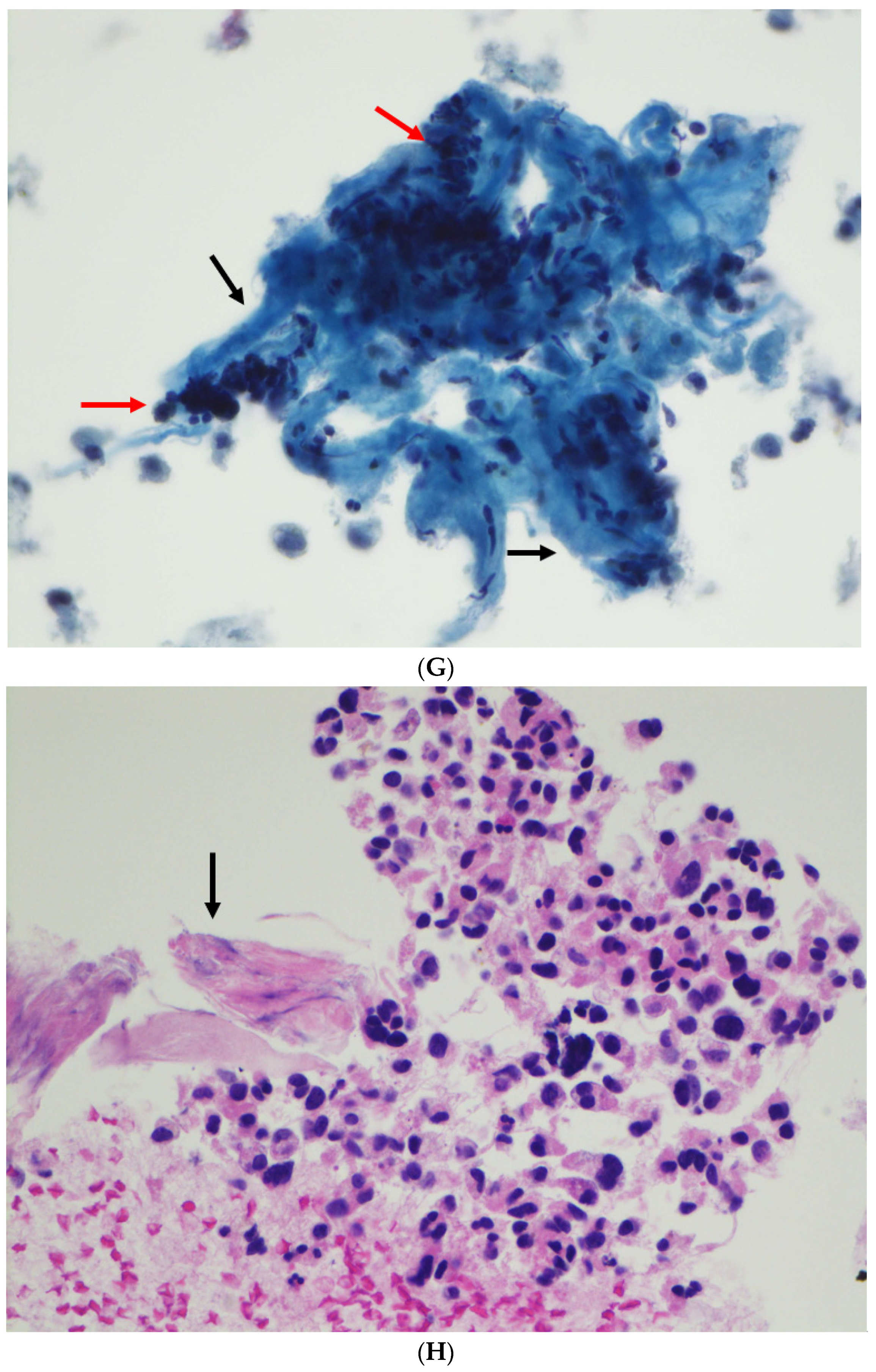 Diagnostics 12 00449 g002d 550