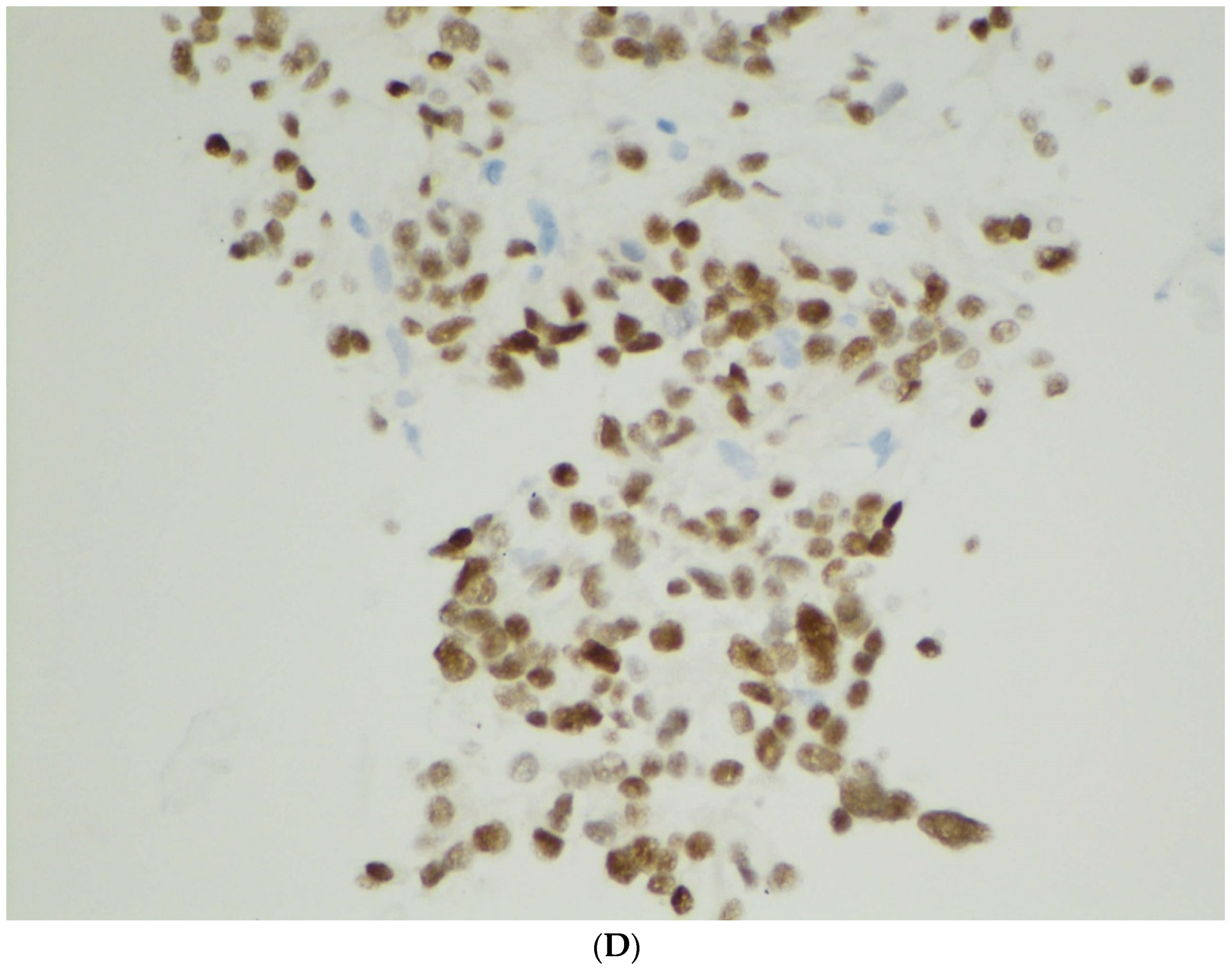 Diagnostics 12 00449 g003c 550