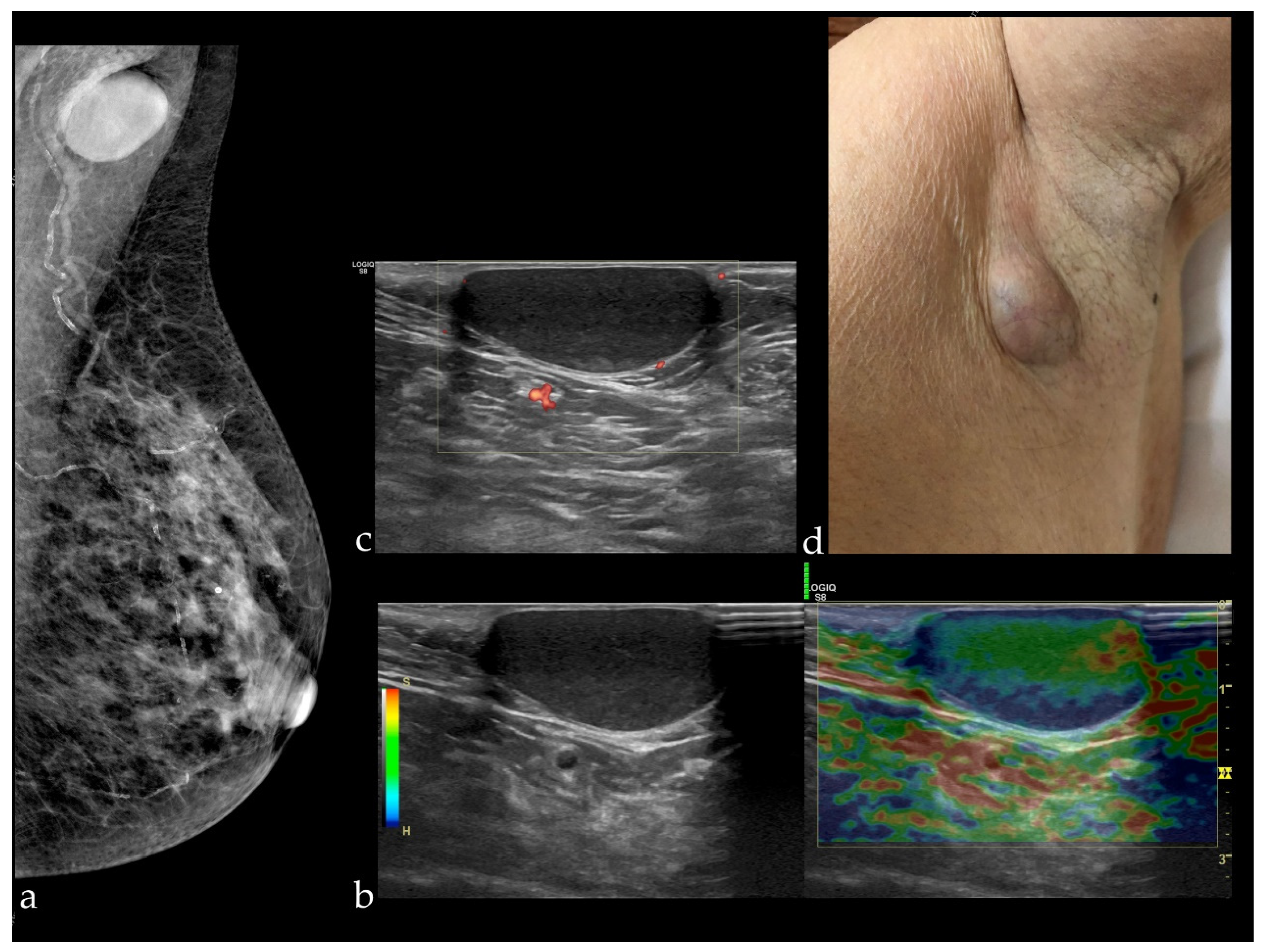 Diagnostics 12 00459 g003 Diagnostics 12 00459 g003