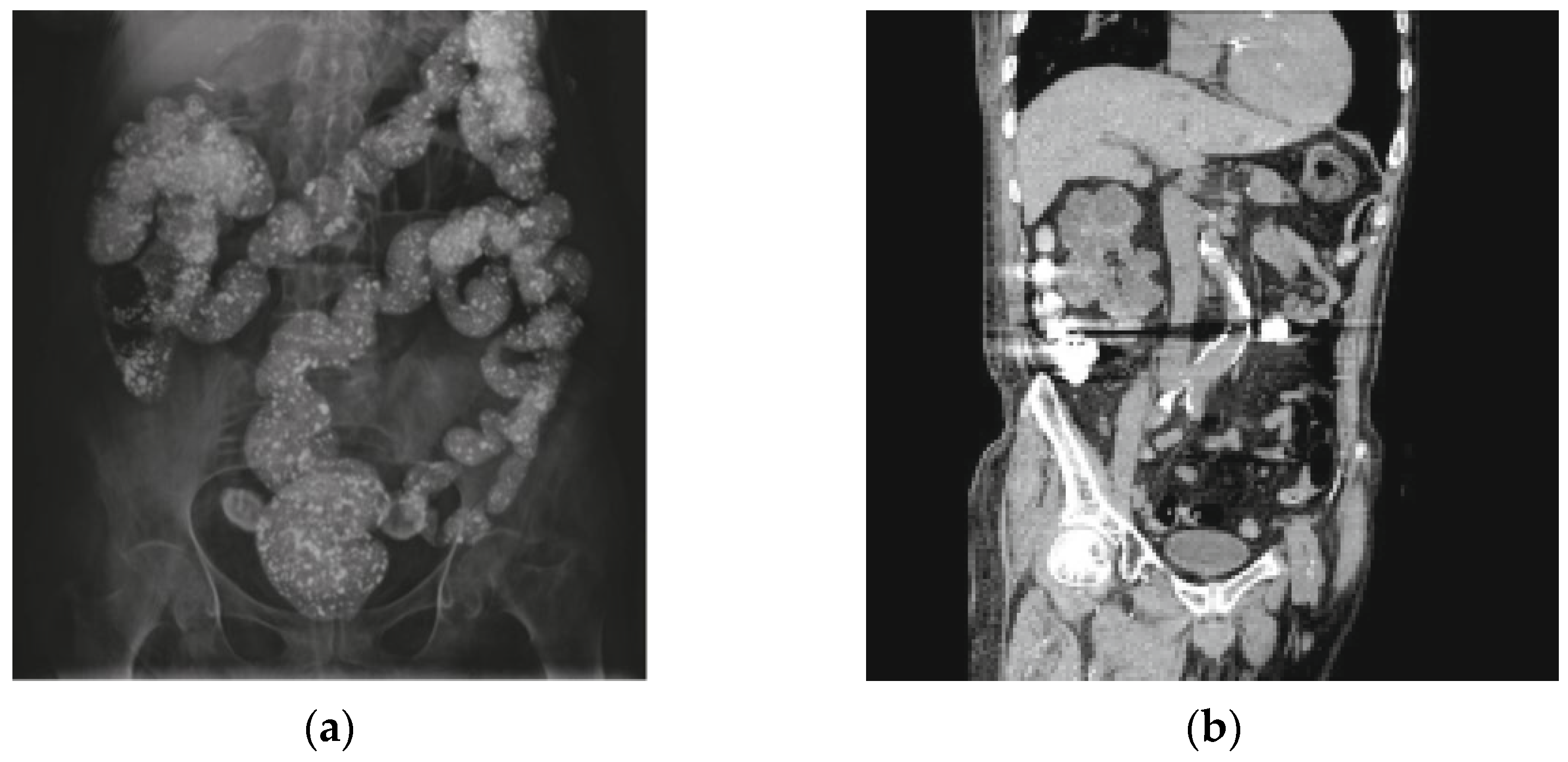 Diagnostics 12 00464 g003
