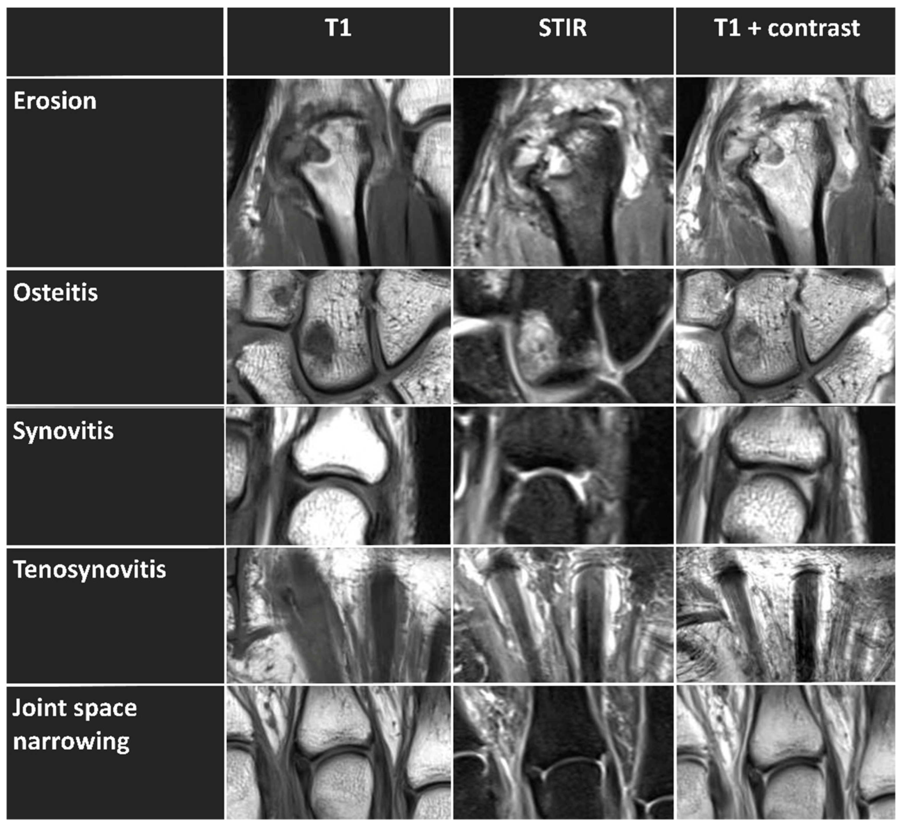 Diagnostics 12 00465 g001 550