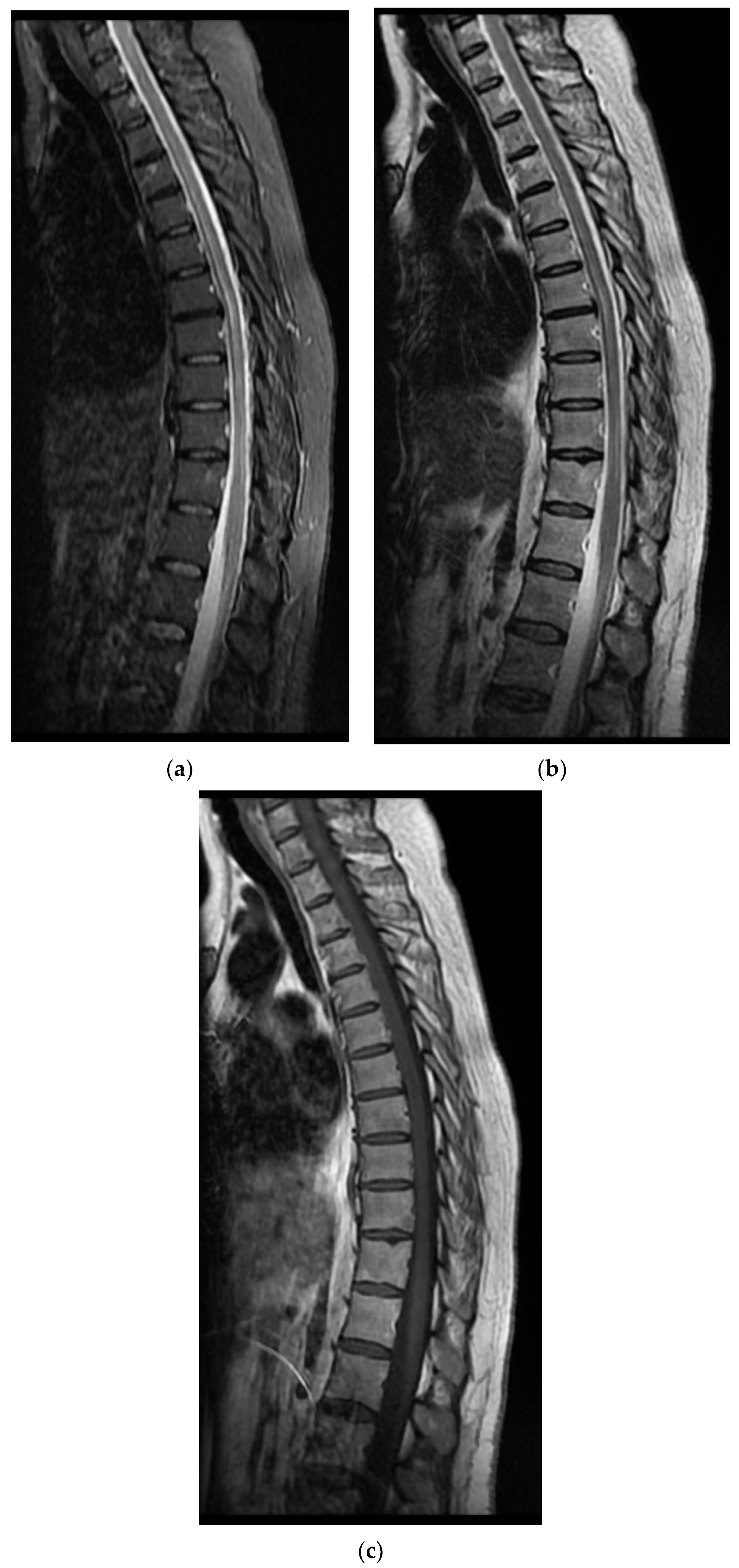 Diagnostics 12 00473 g001 550
