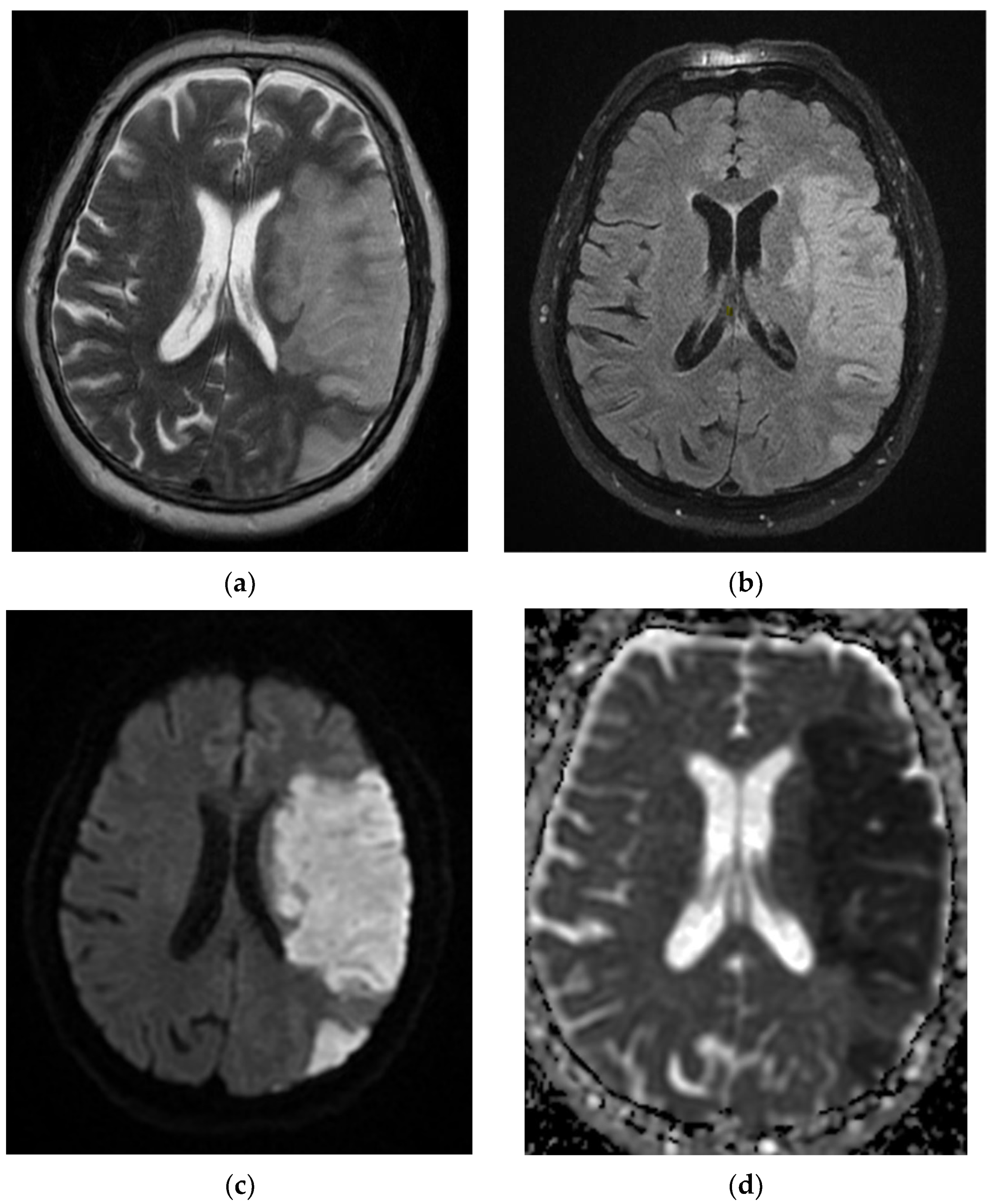 Diagnostics 12 00473 g002a 550