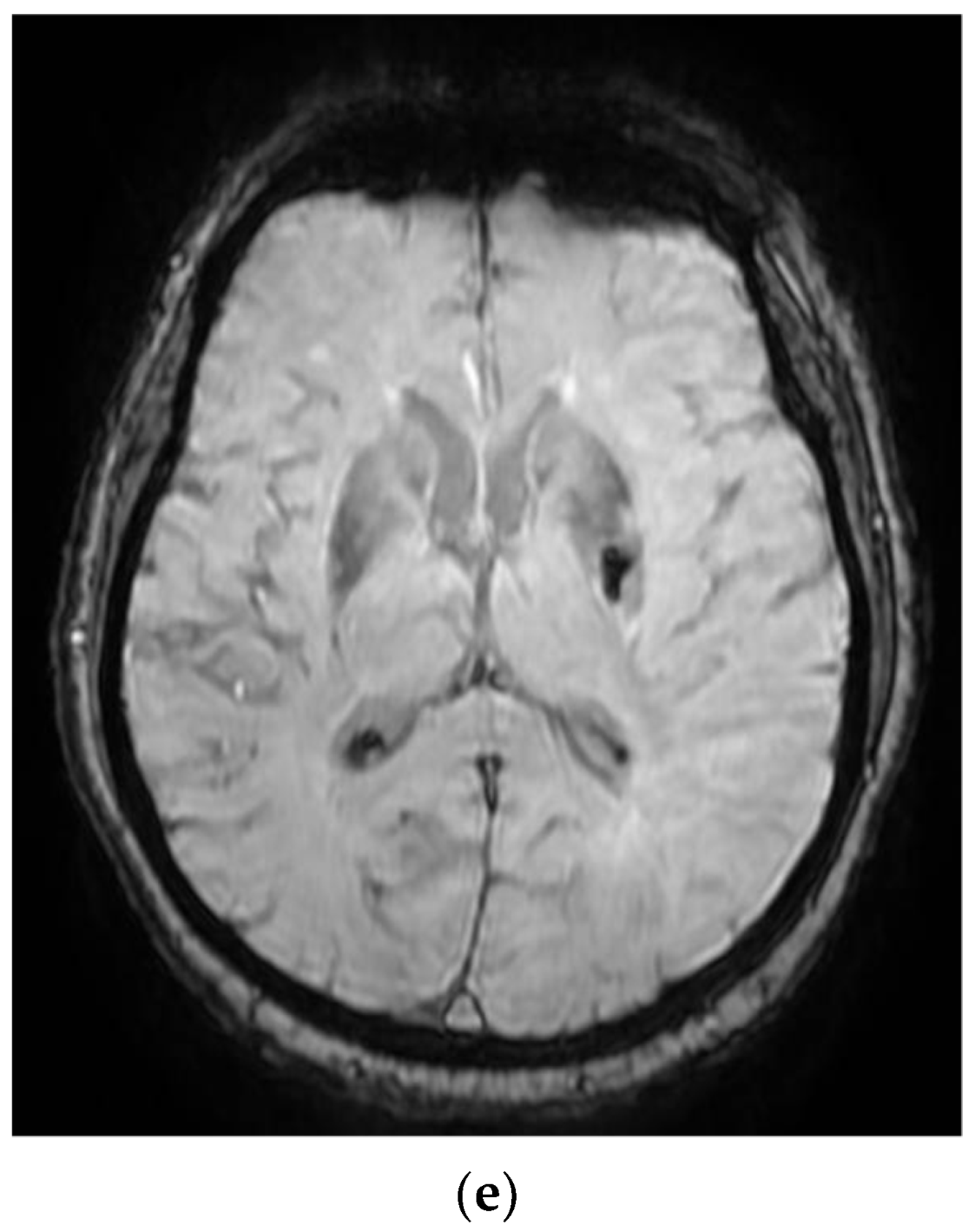 Diagnostics 12 00473 g002b 550