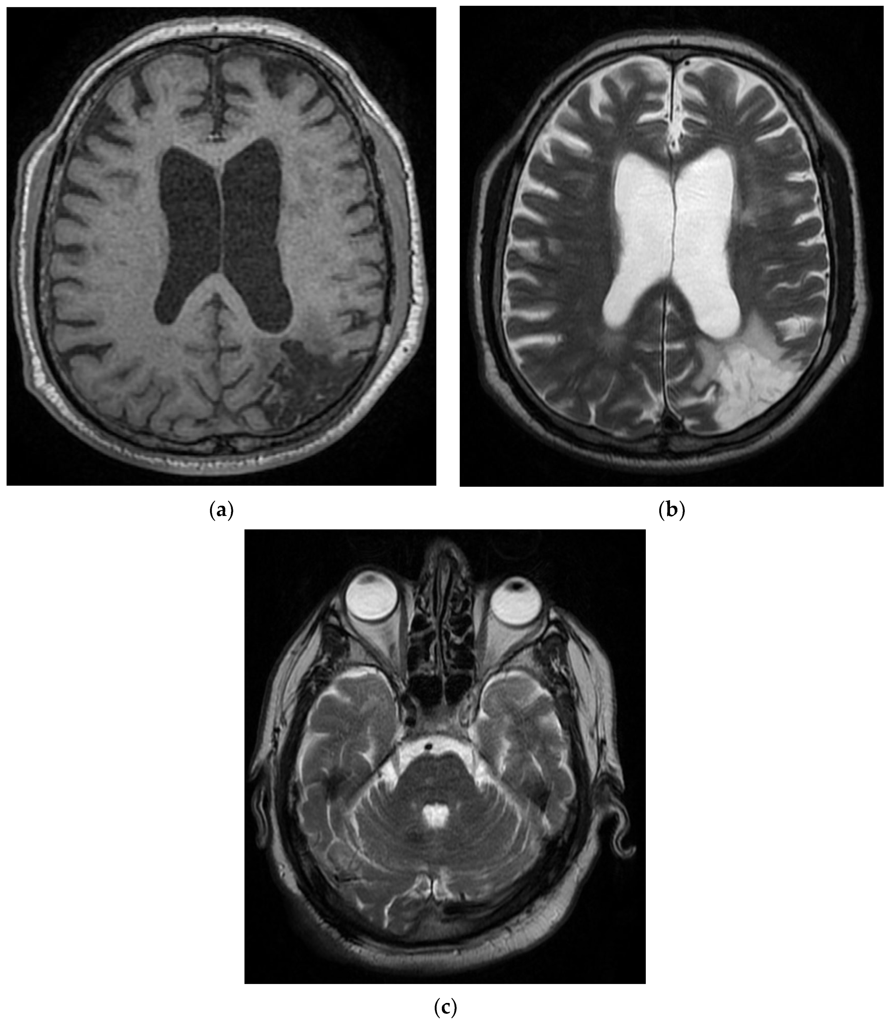 Diagnostics 12 00473 g004 550