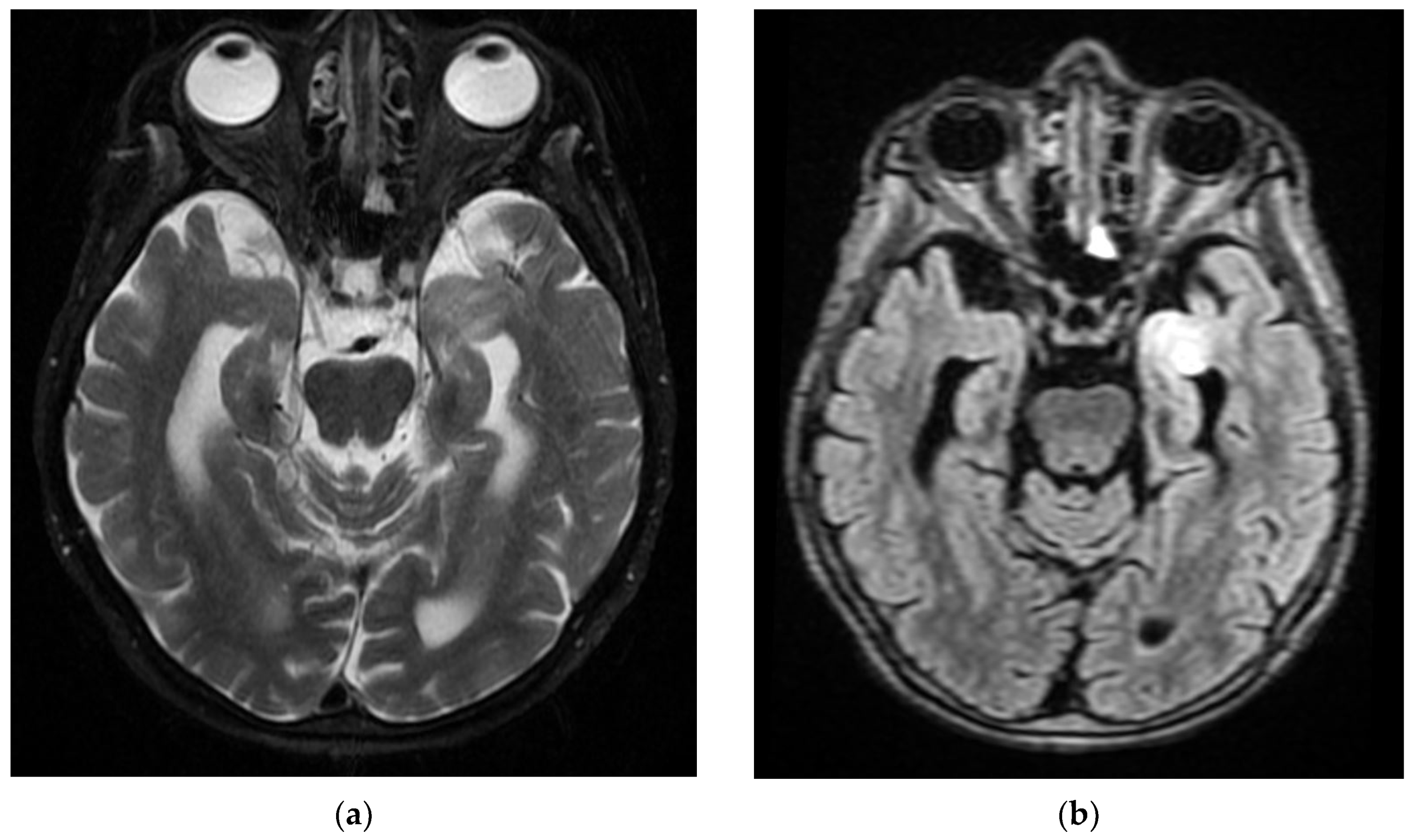 Diagnostics 12 00473 g005a 550