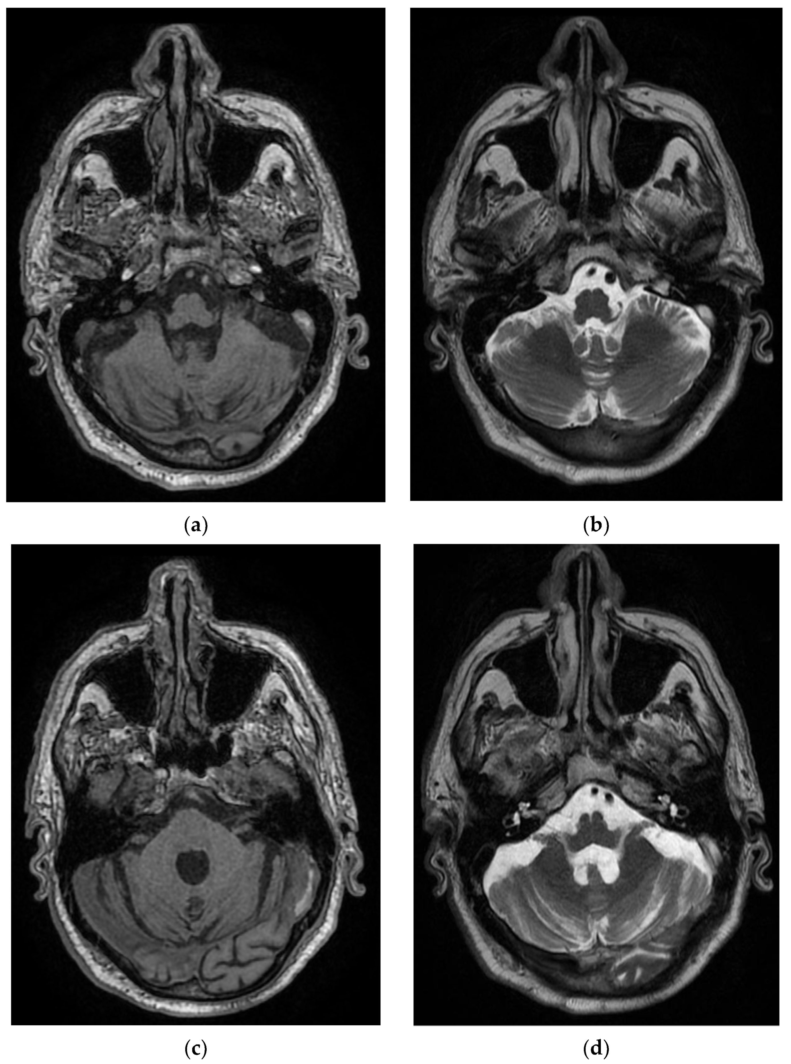 Diagnostics 12 00473 g006a 550