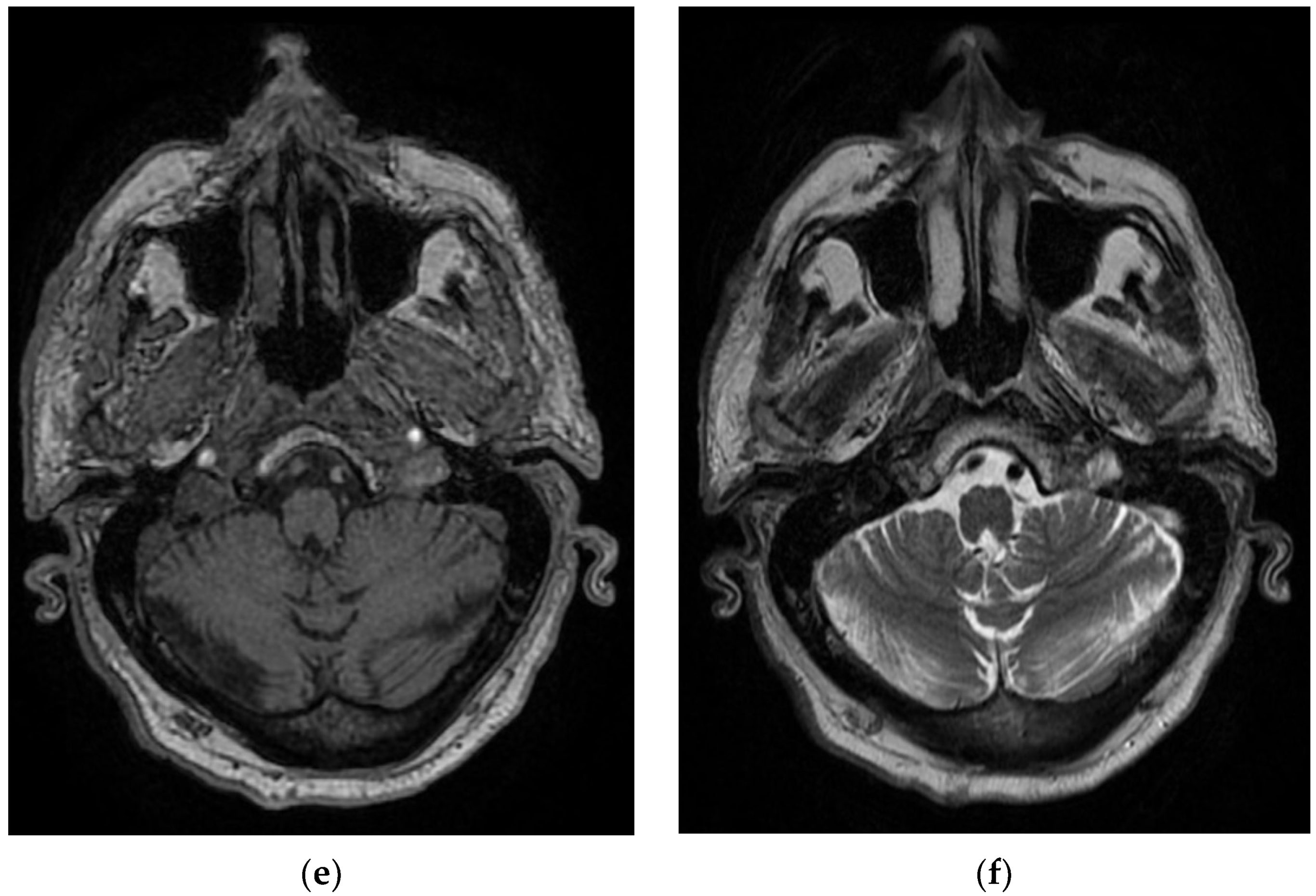 Diagnostics 12 00473 g006b 550