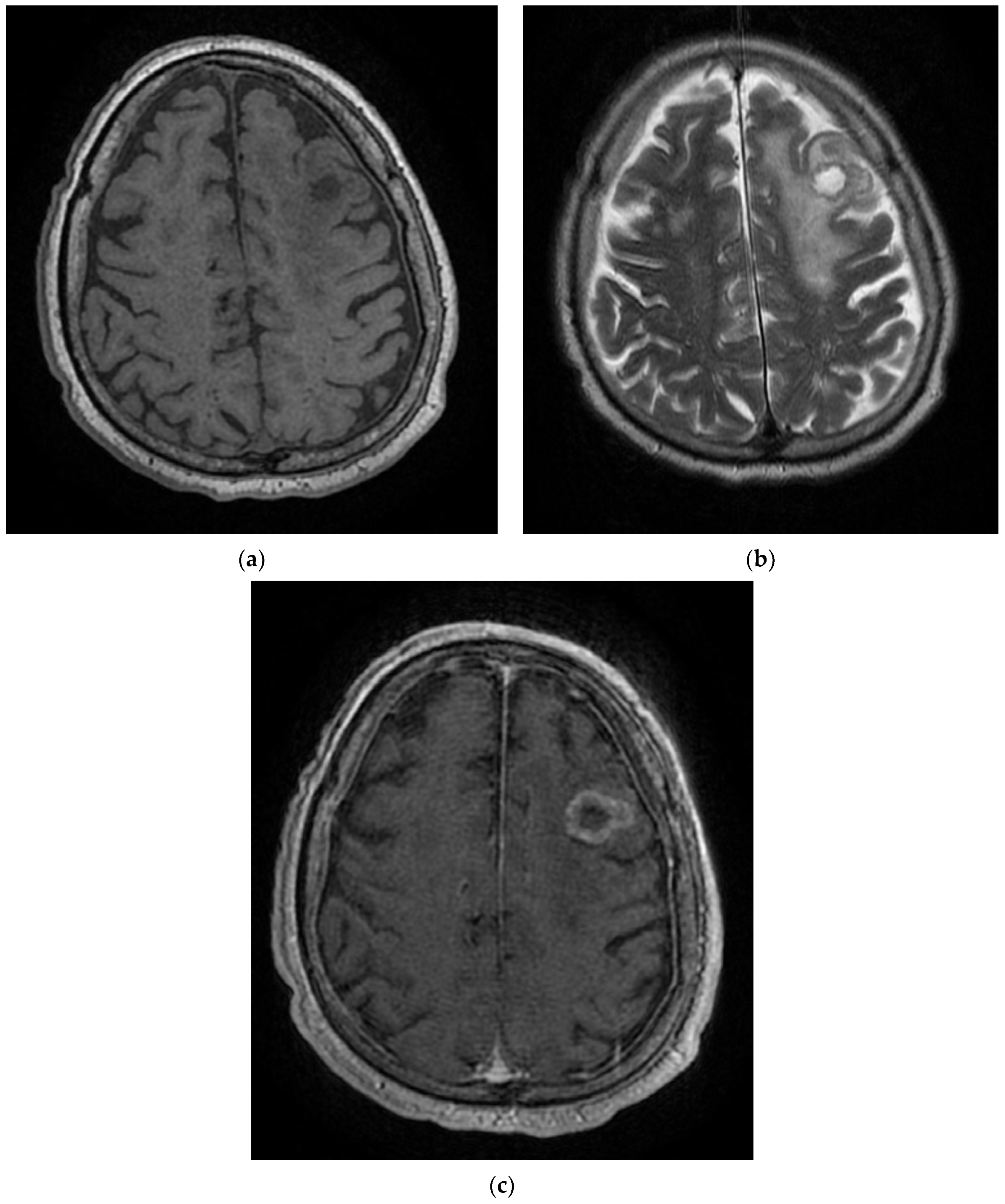 Diagnostics 12 00473 g007 550