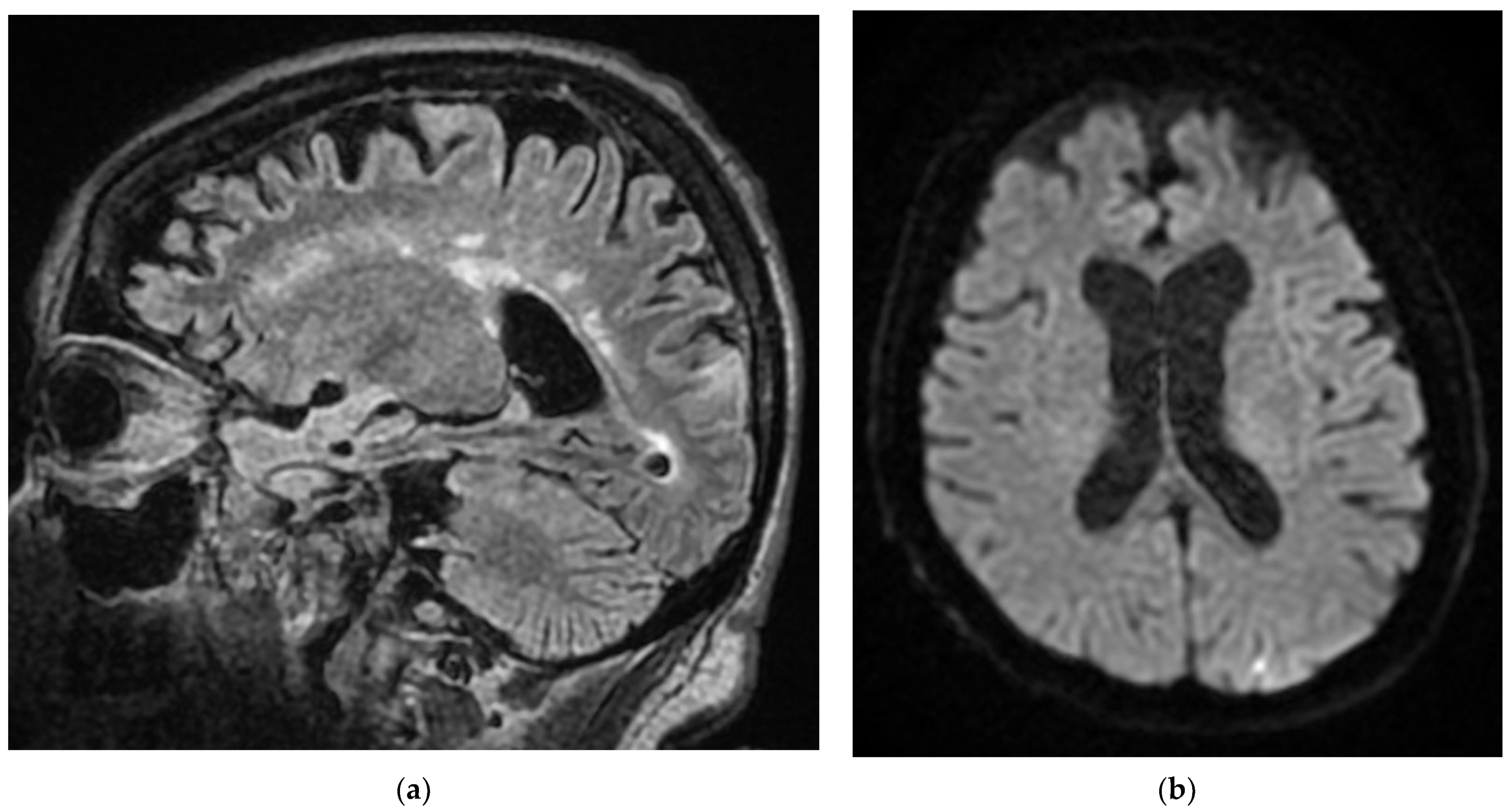 Diagnostics 12 00473 g008a 550
