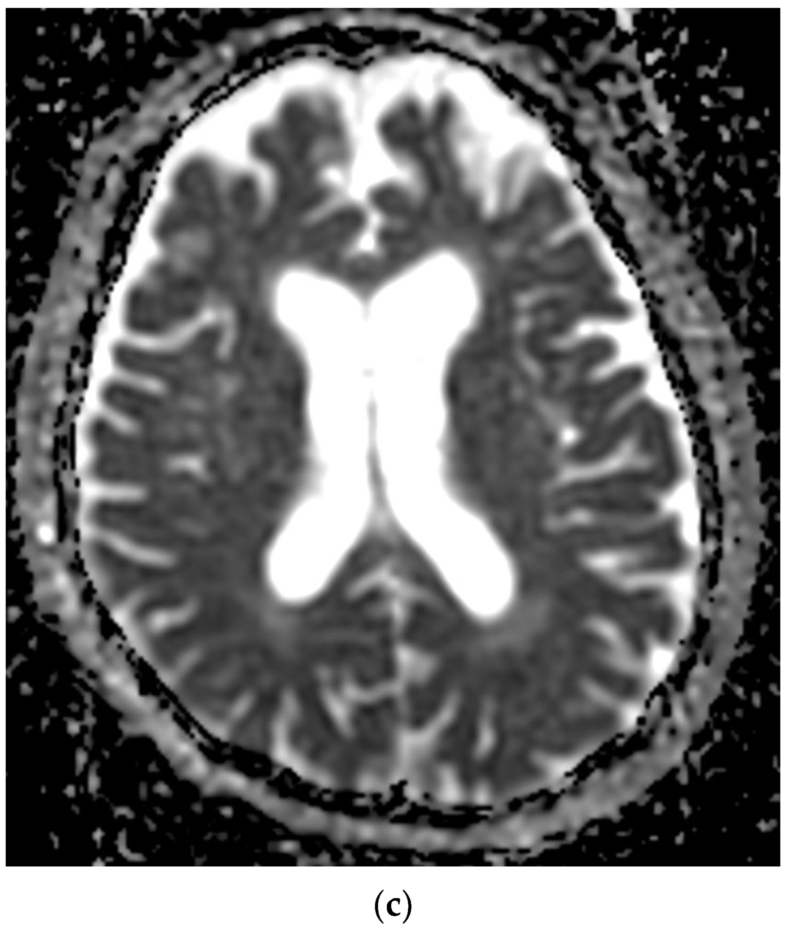Diagnostics 12 00473 g008b 550