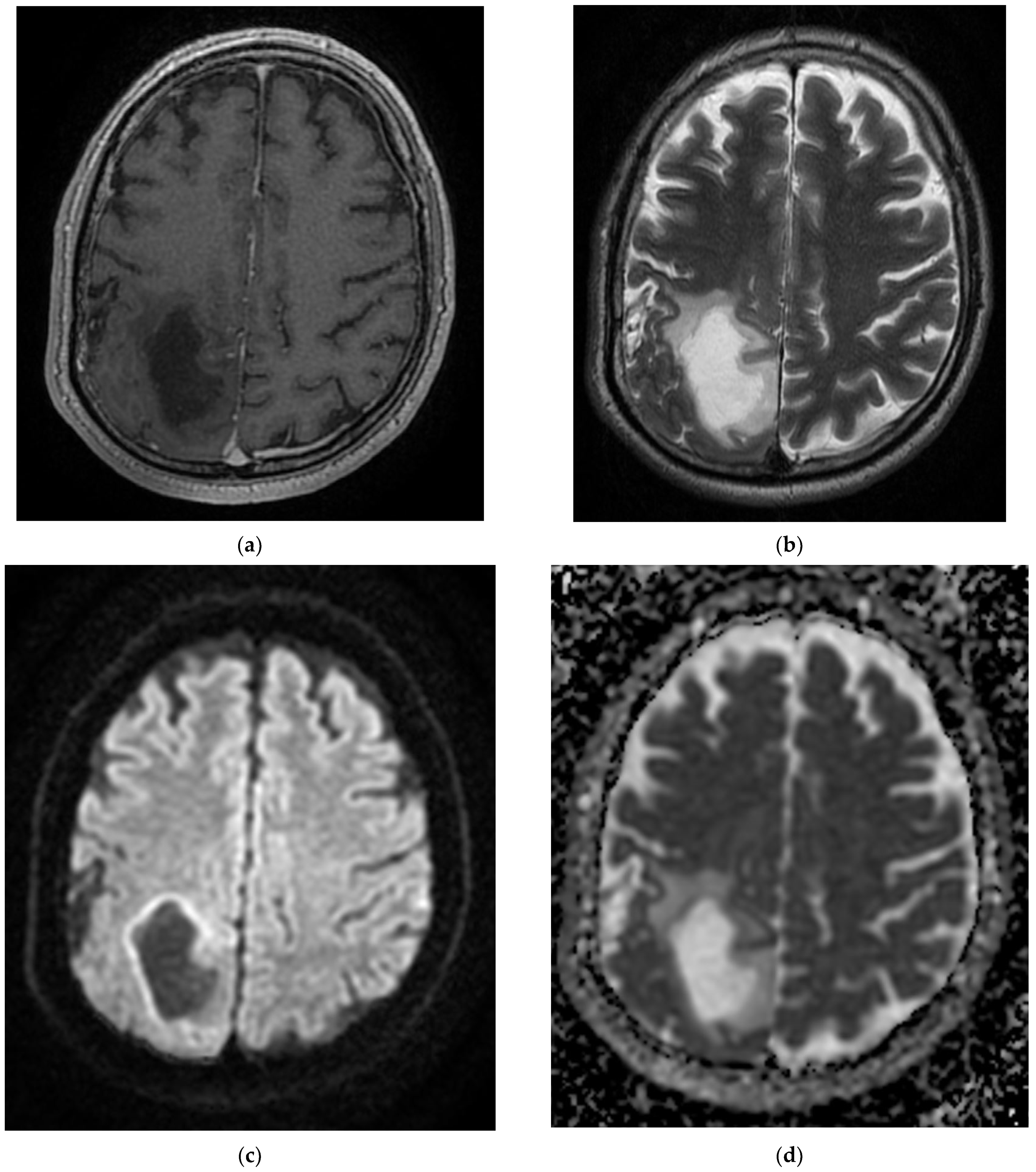 Diagnostics 12 00473 g009a 550