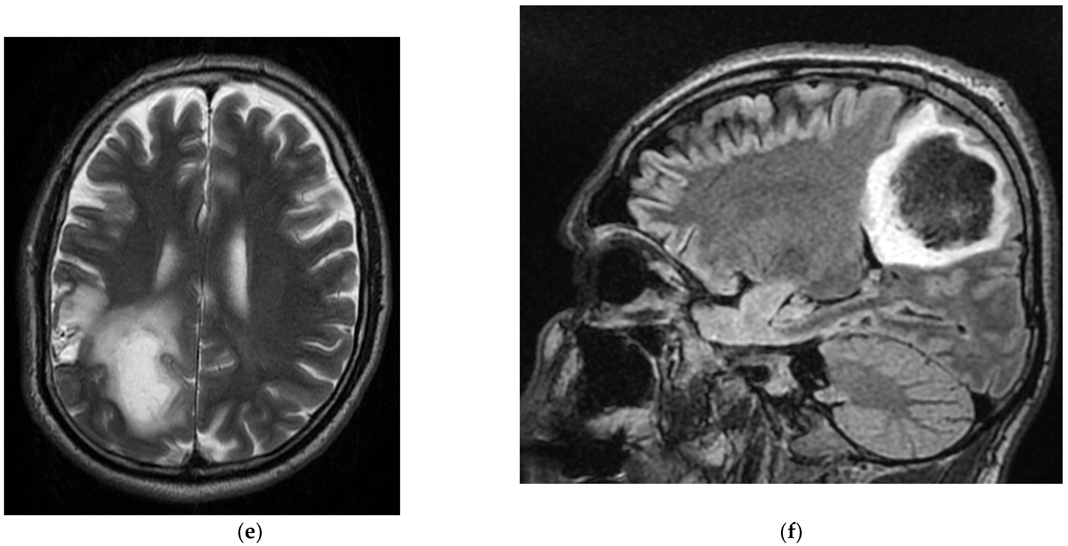 Diagnostics 12 00473 g009b 550