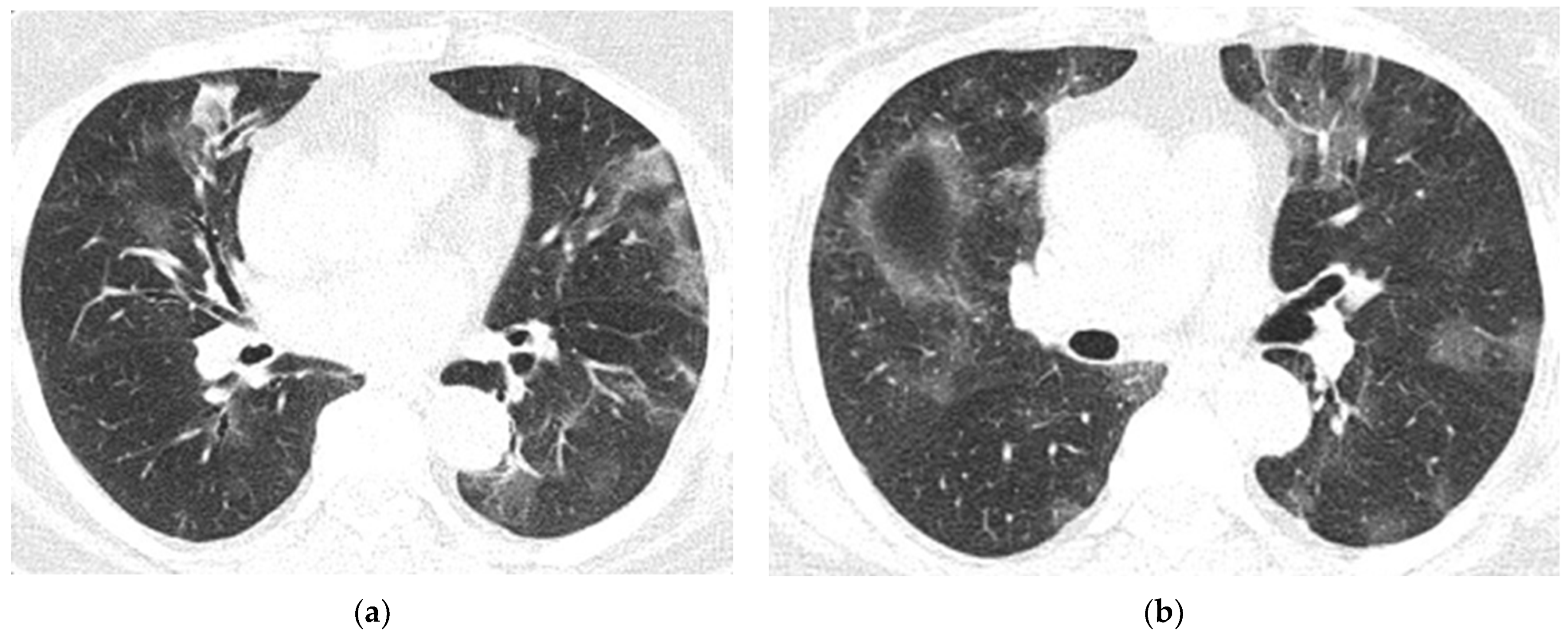 Diagnostics 12 00473 g010 550