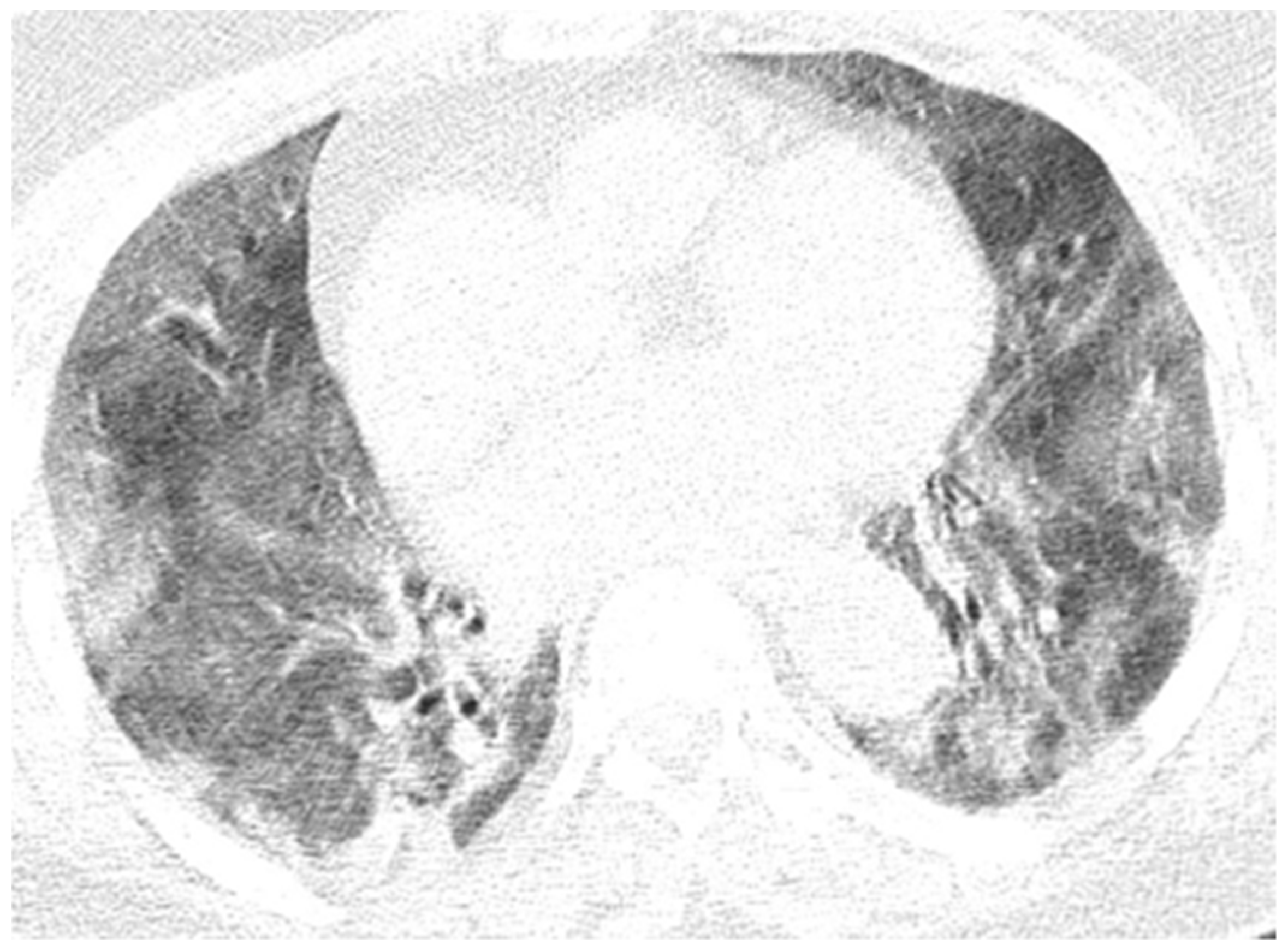 Diagnostics 12 00473 g012 550
