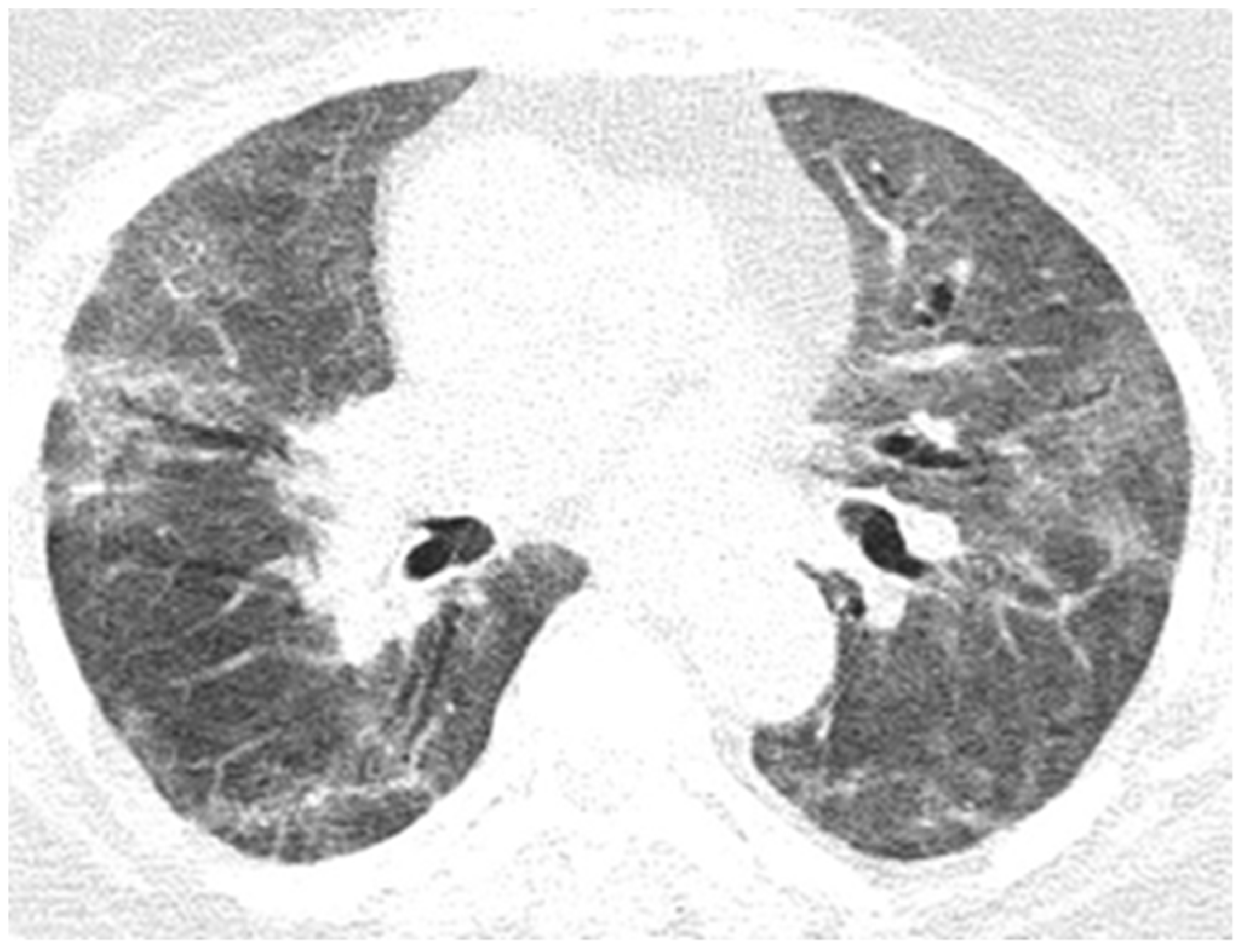 Diagnostics 12 00473 g013 550