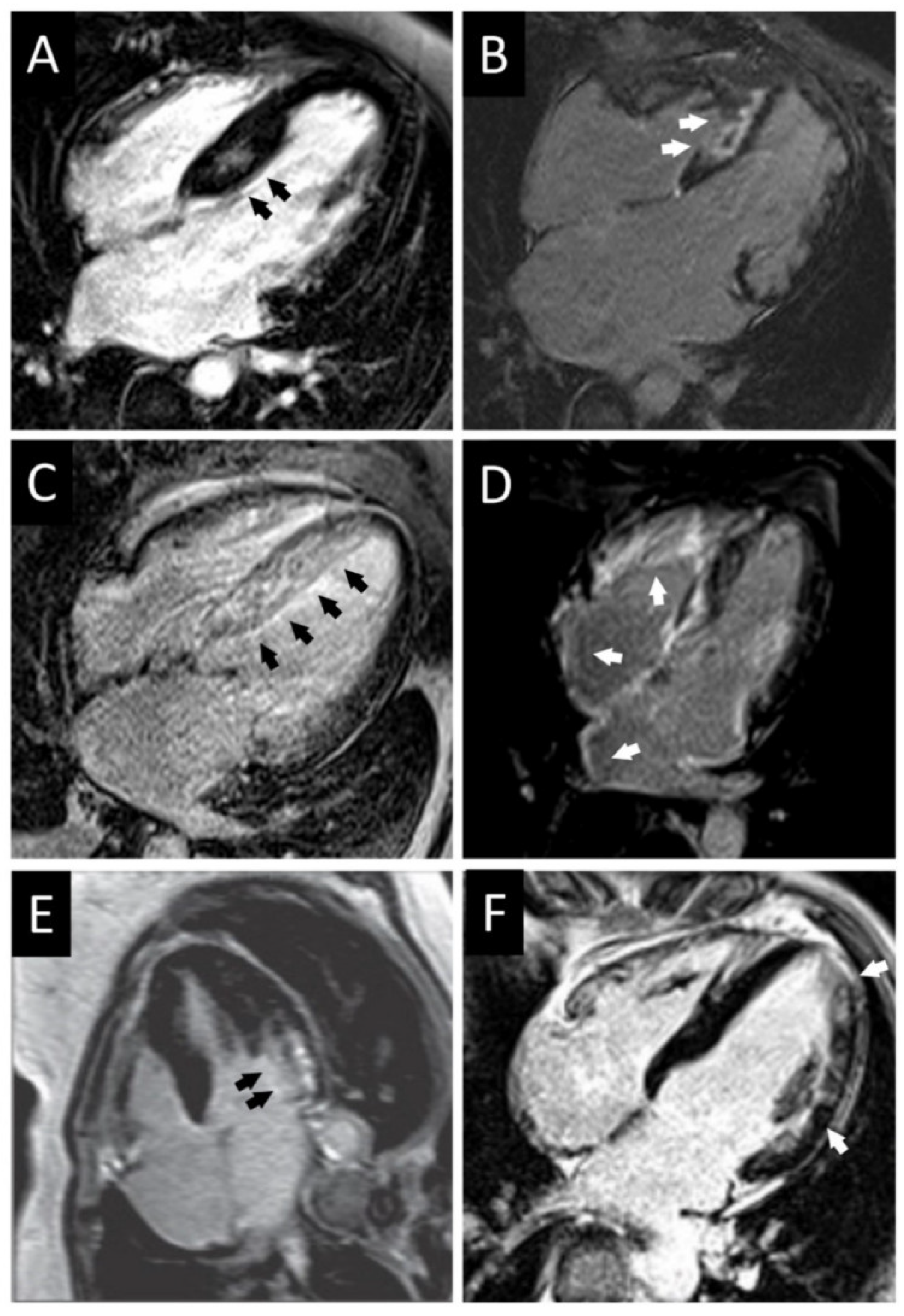 Diagnostics 12 00489 g009 Diagnostics 12 00489 g009