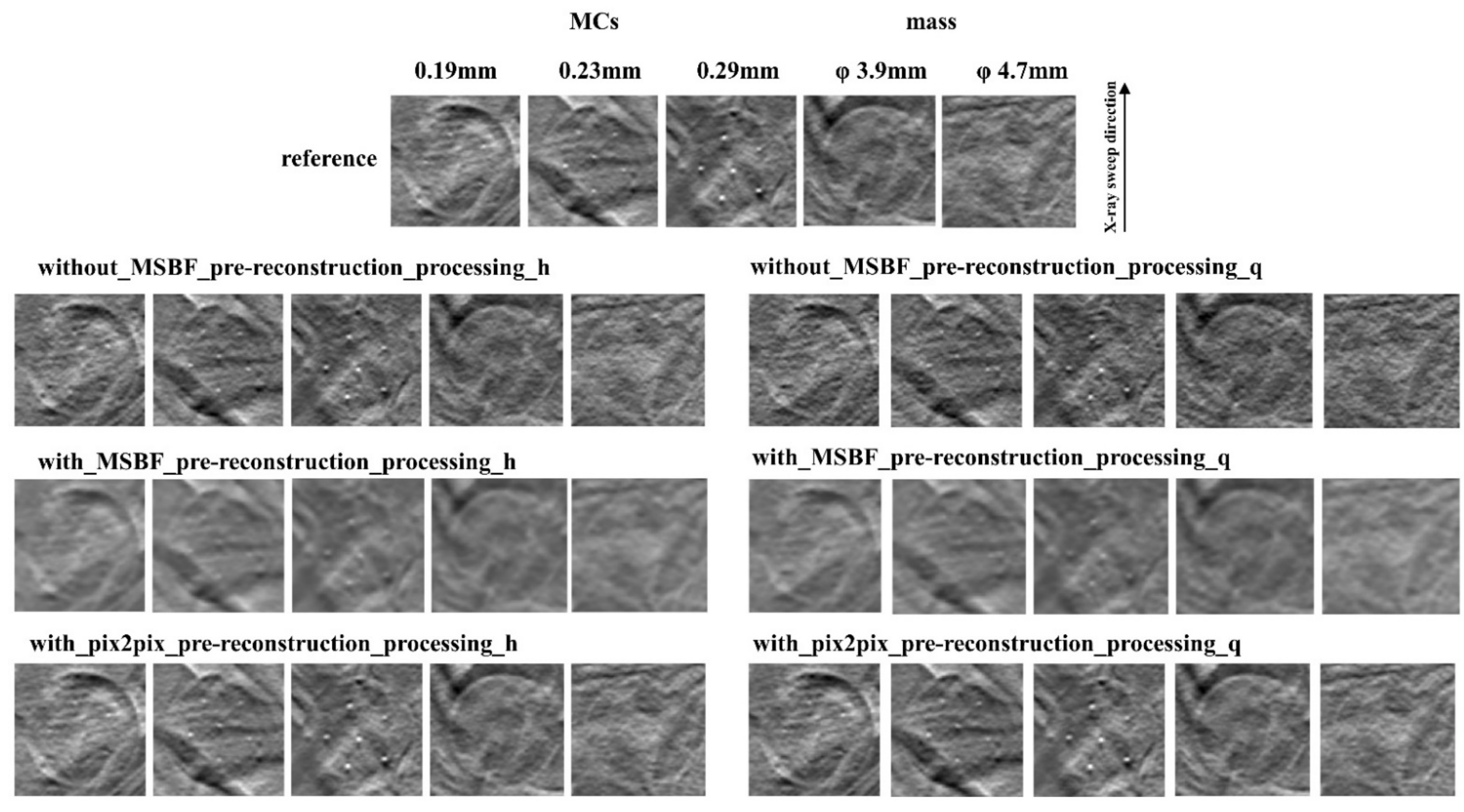 Diagnostics 12 00495 g004 Diagnostics 12 00495 g004