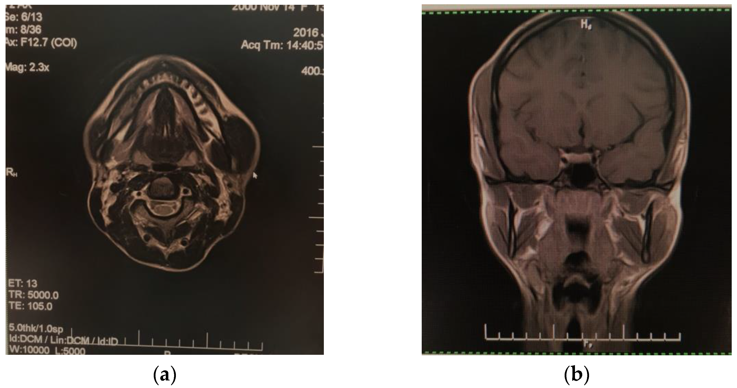Diagnostics 12 00505 g002 550