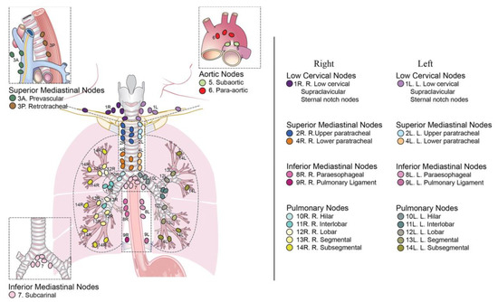 Diagnostics | Free Full-Text | Role of EBUS-TBNA in Non-Neoplastic ...