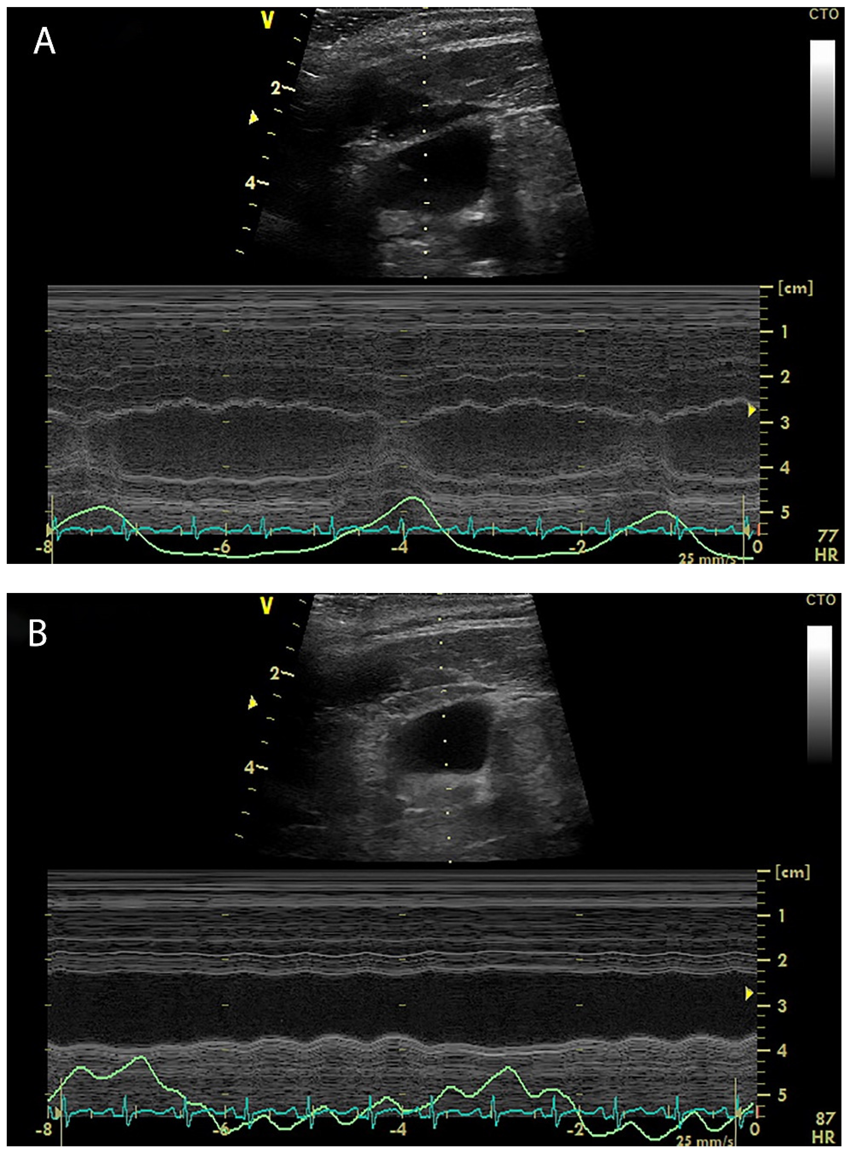 Diagnostics 12 00513 g002 Diagnostics 12 00513 g002