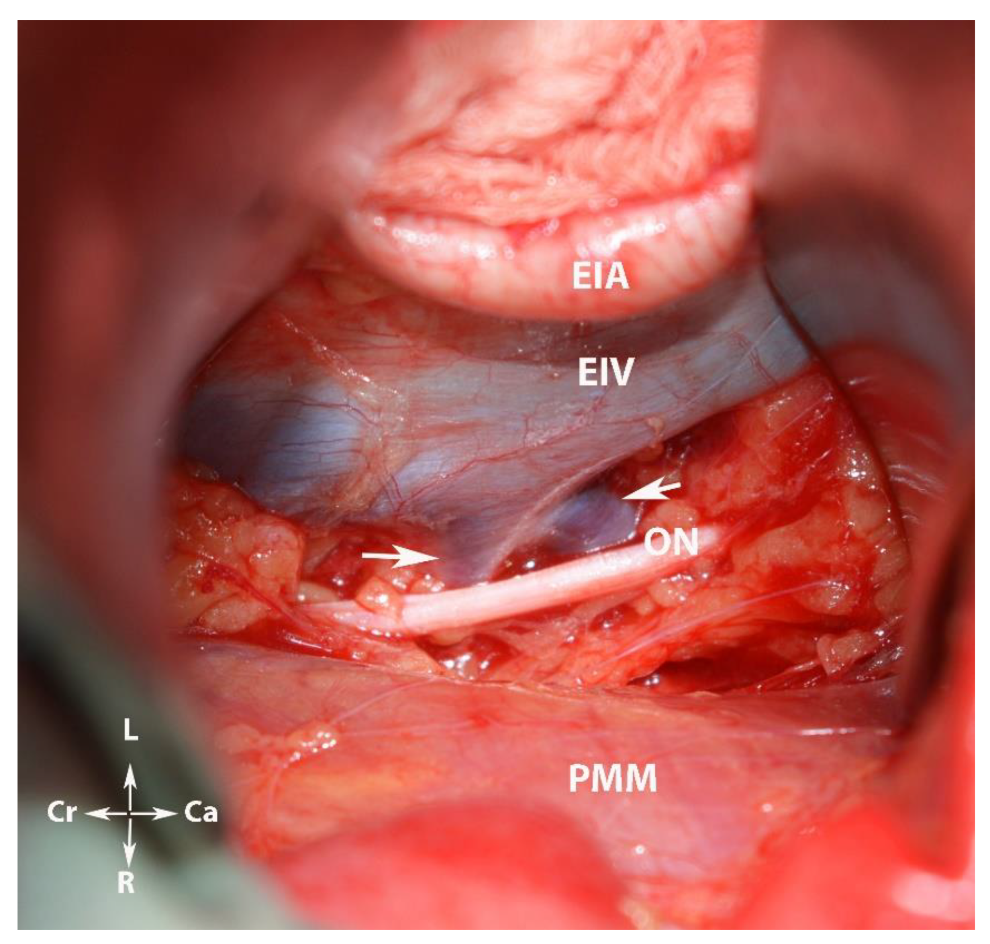 Diagnostics 12 00519 g013 550