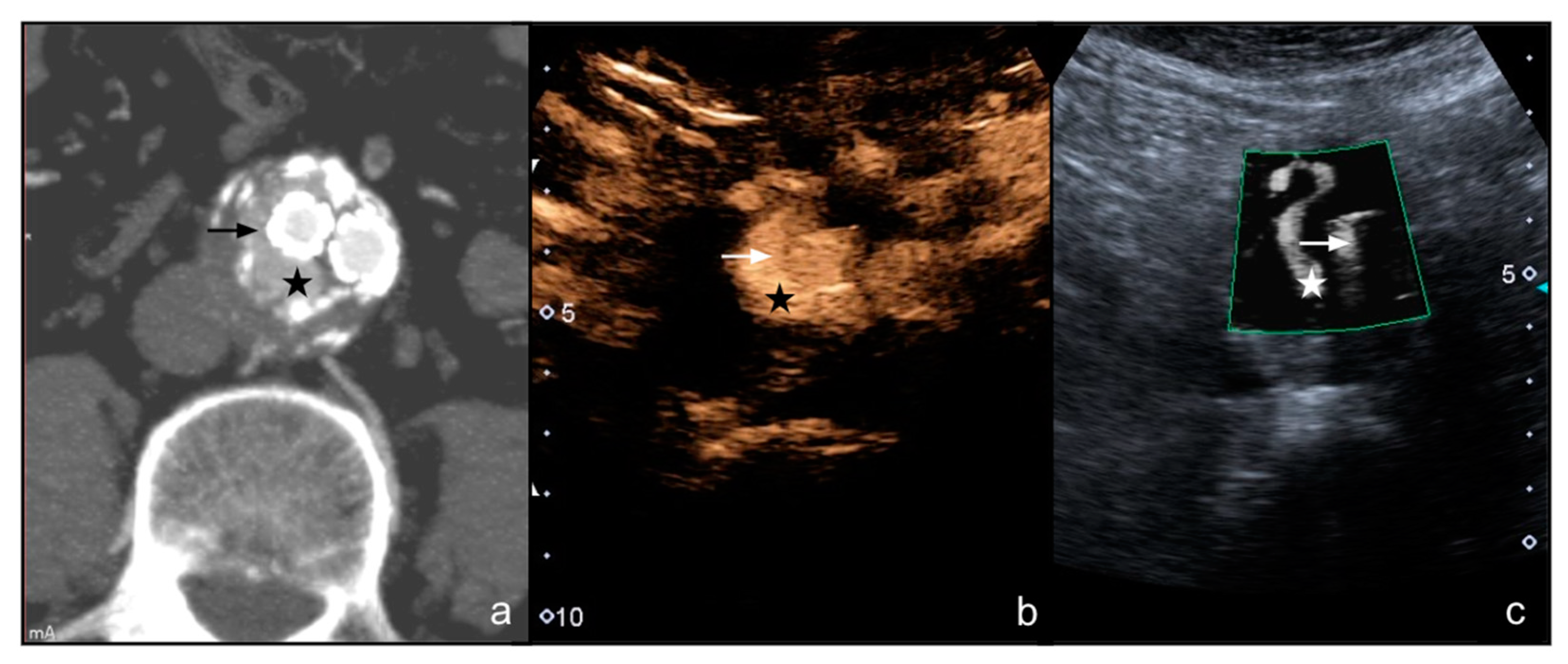 Diagnostics 12 00526 g003