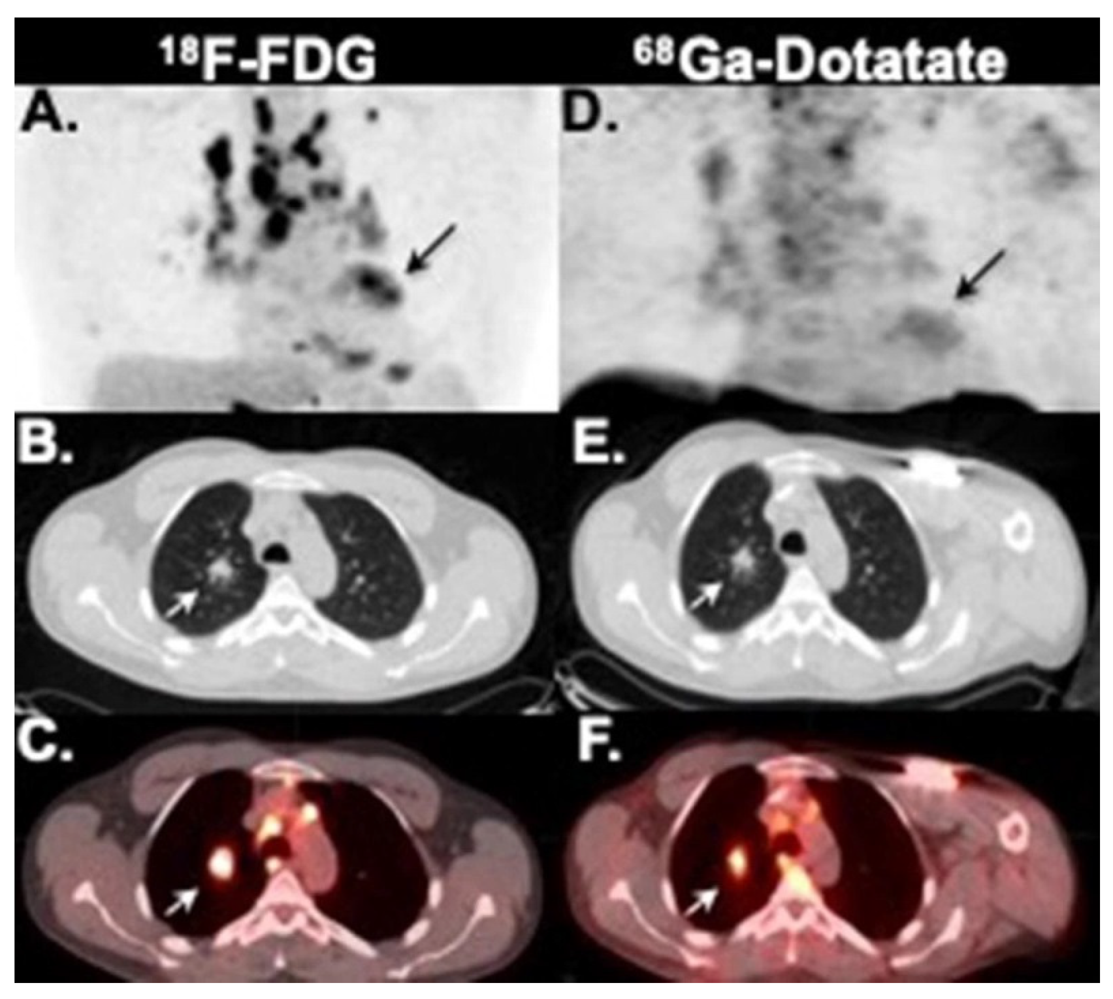 Diagnostics 12 00528 g004 Diagnostics 12 00528 g004