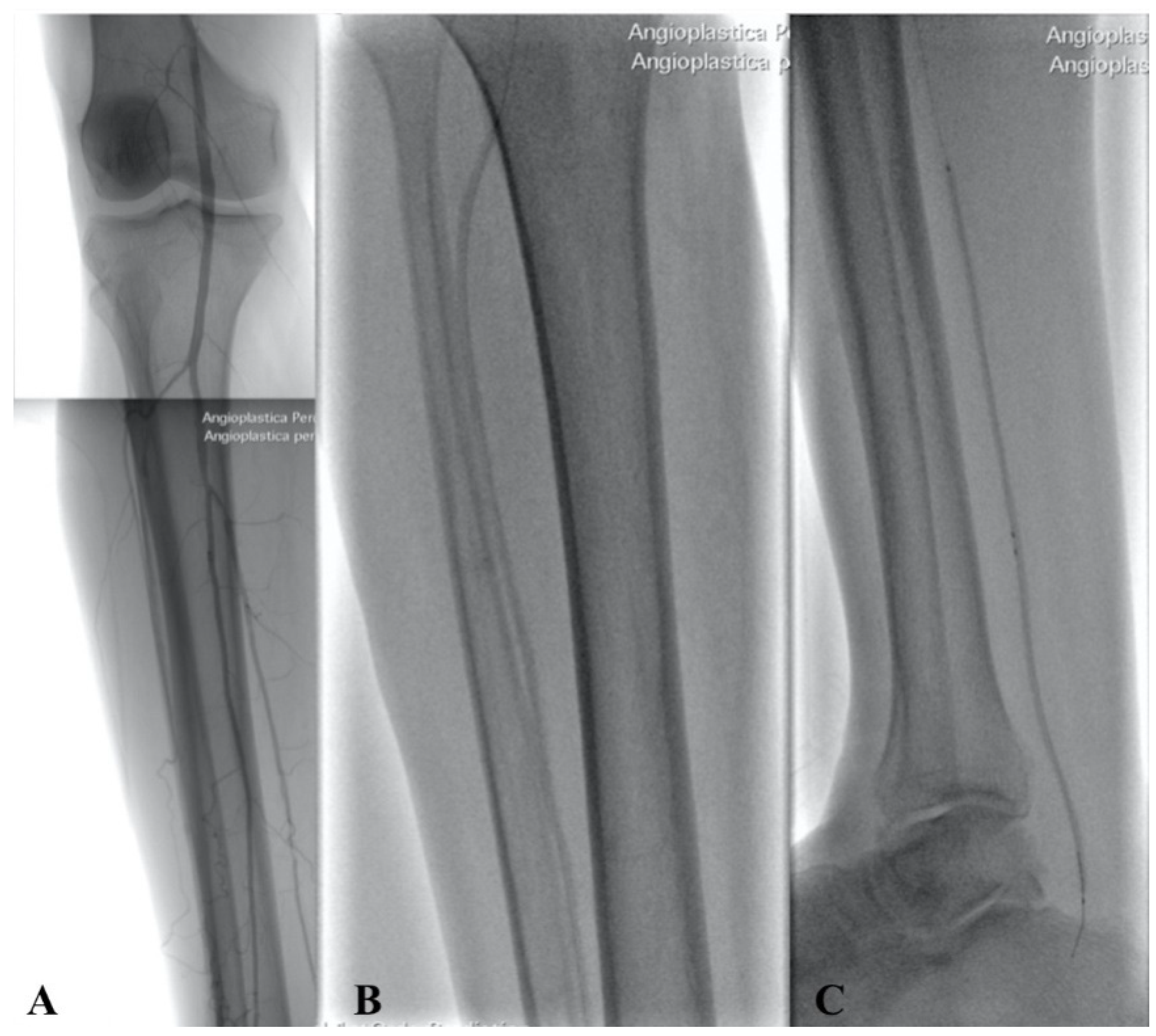 Diagnostics 12 00538 g004