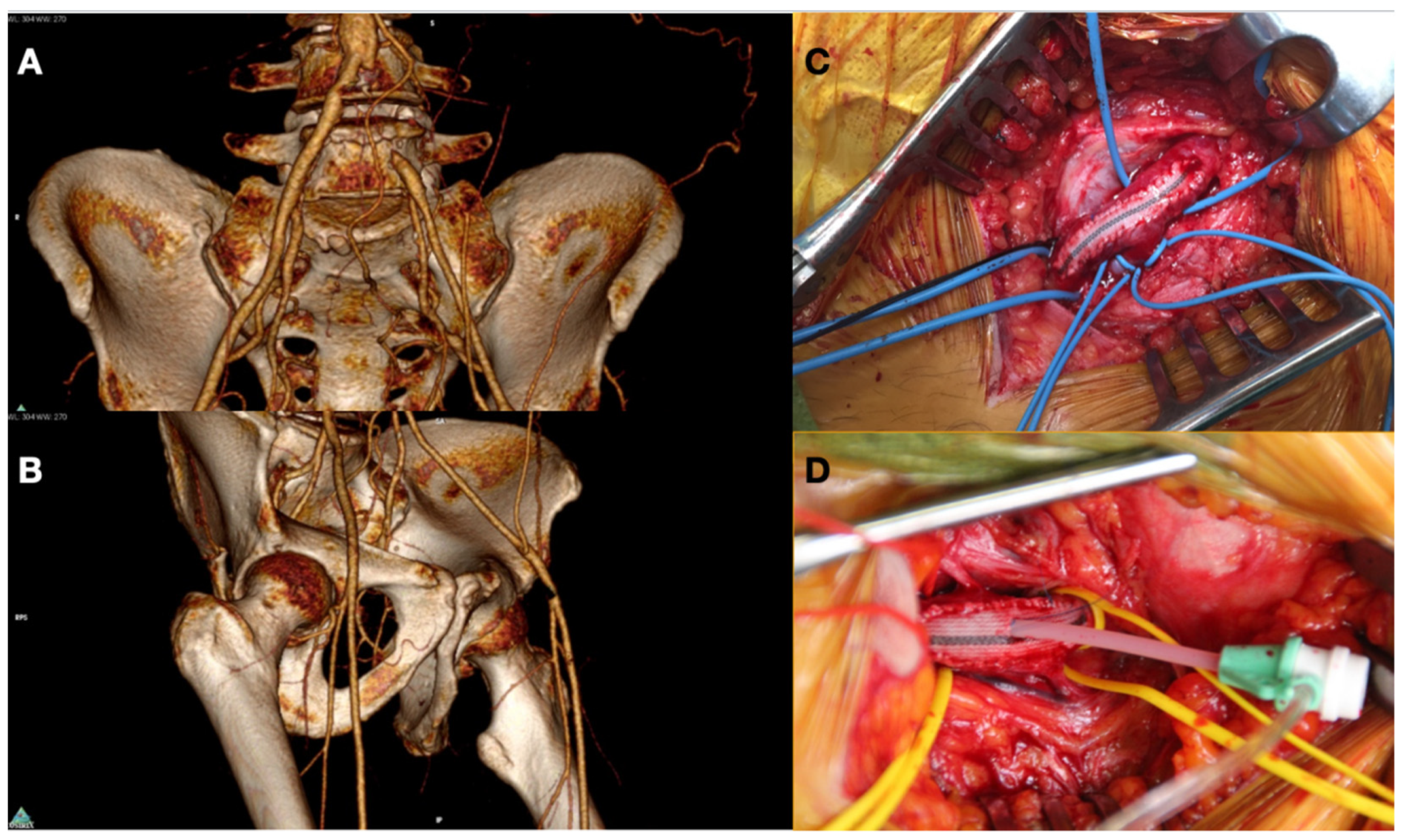 Diagnostics 12 00538 g005