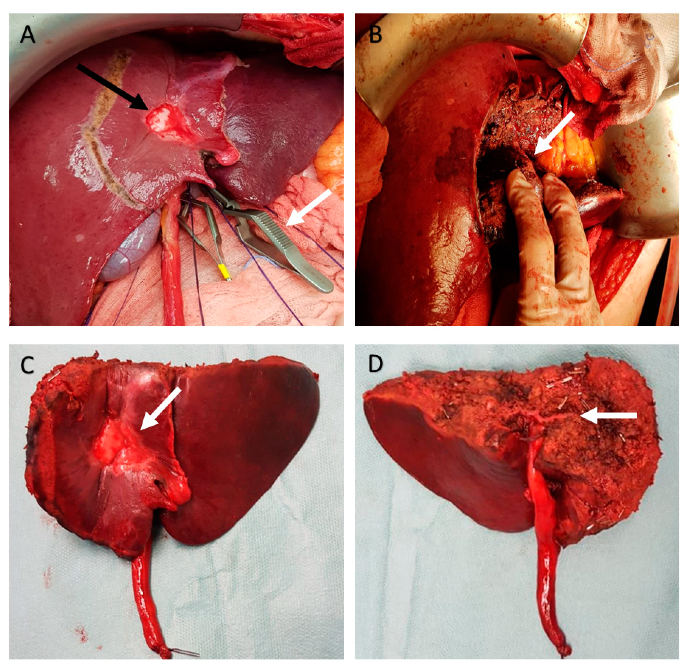 Diagnostics 12 00545 g003 550