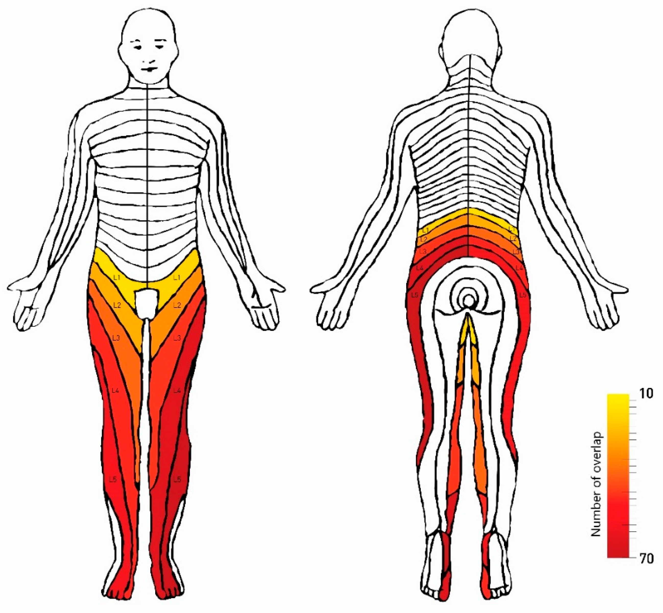 Diagnostics Free Full Text Associations Between Patient Report Of Pain And Intervertebral Foramina Changes Visible On Axial Loaded Lumbar Magnetic Resonance Imaging Html
