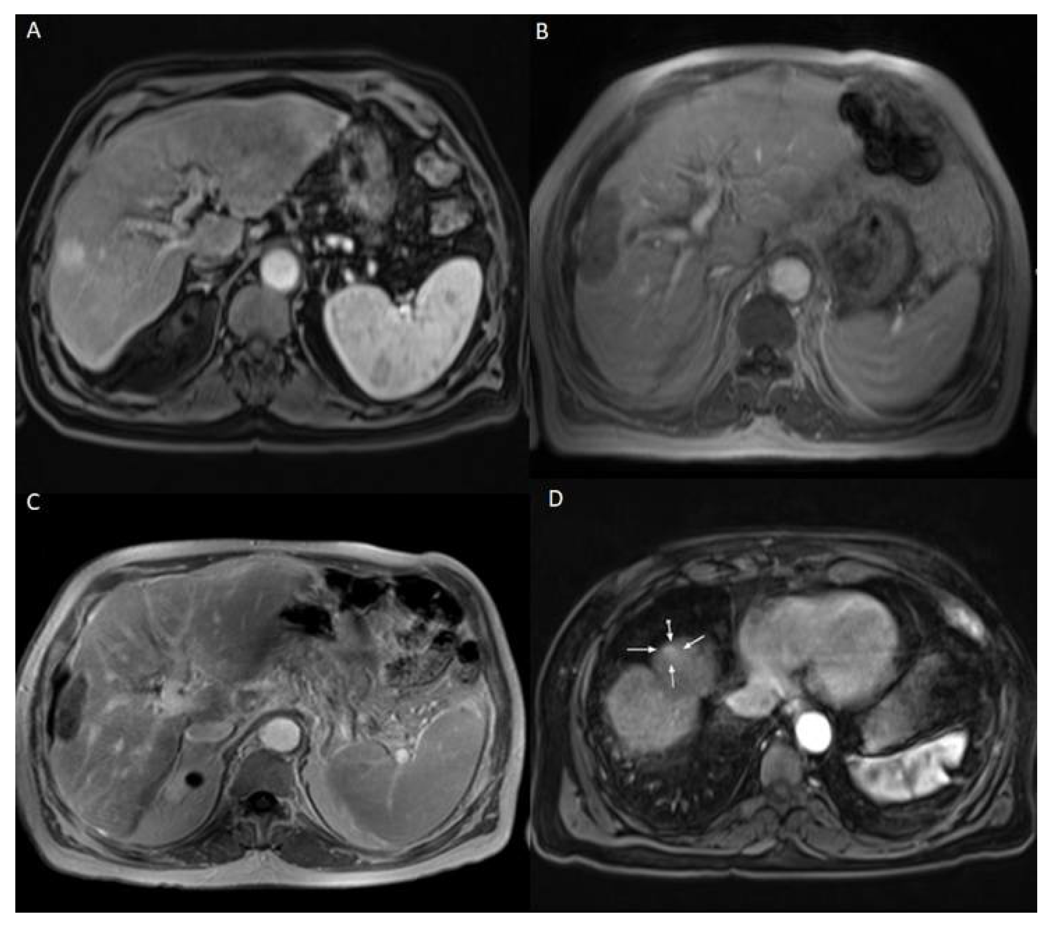 Diagnostics 12 00564 g002 550