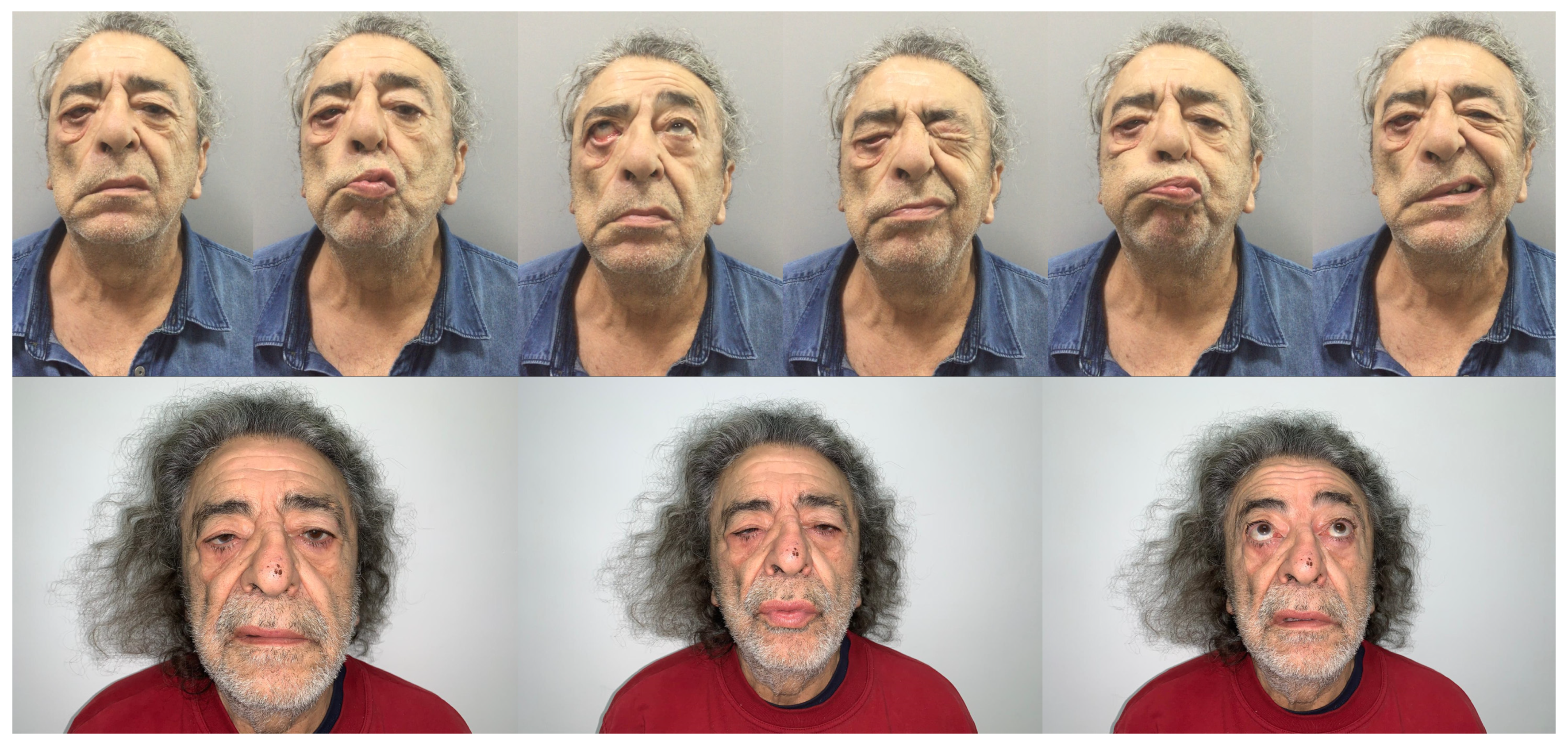 Diagnostics 12 00565 g005