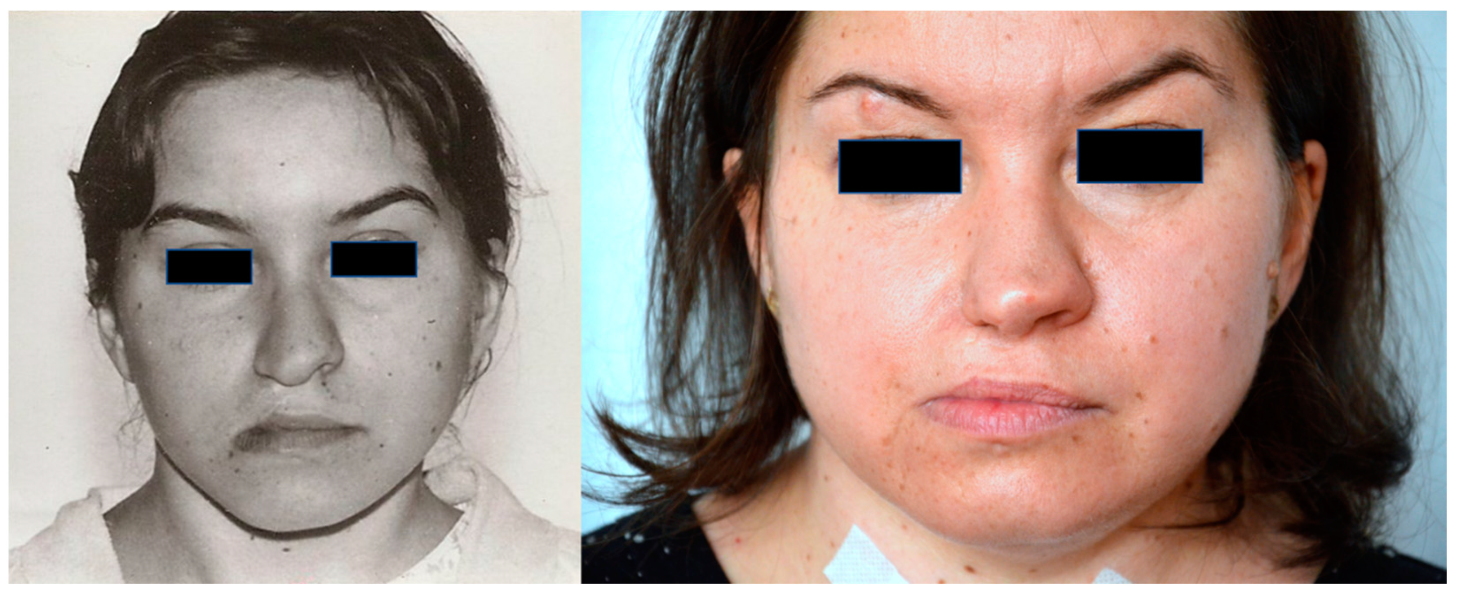 Diagnostics 12 00569 g002