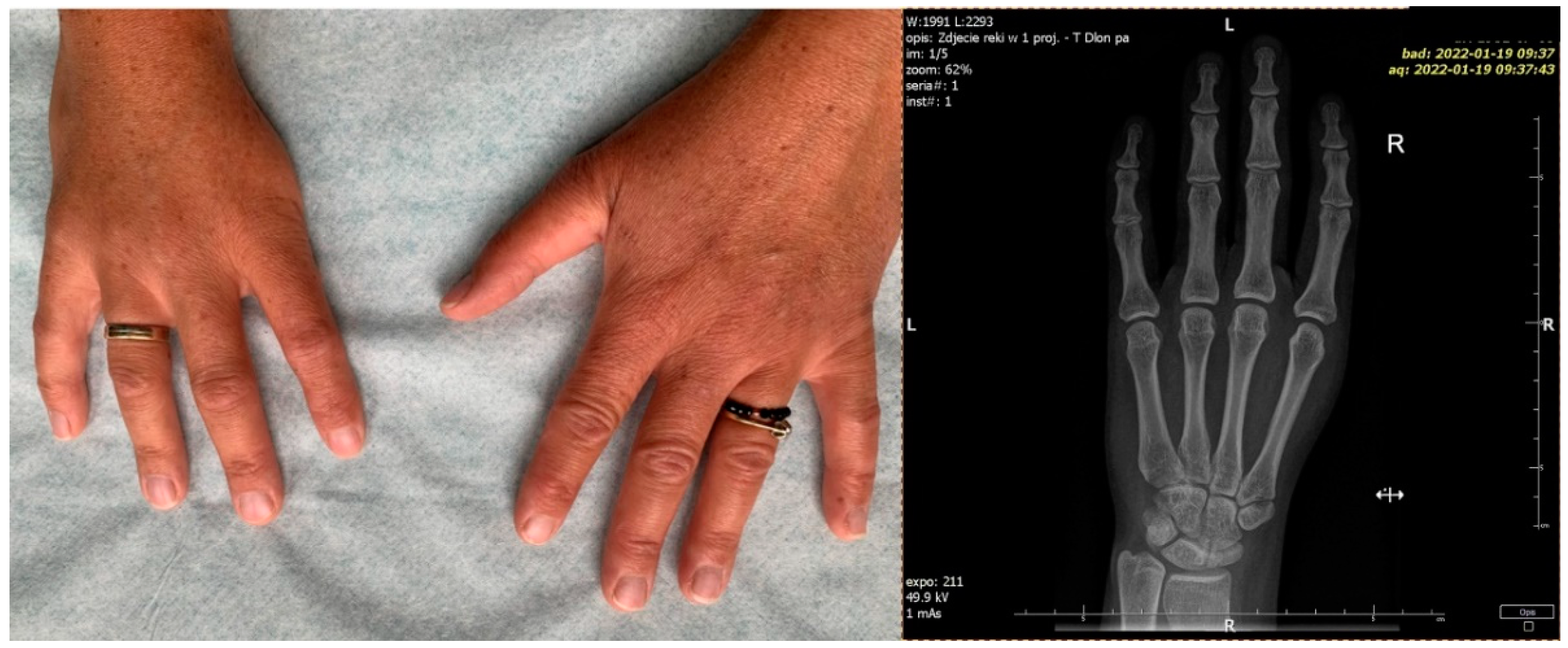 Diagnostics 12 00569 g003