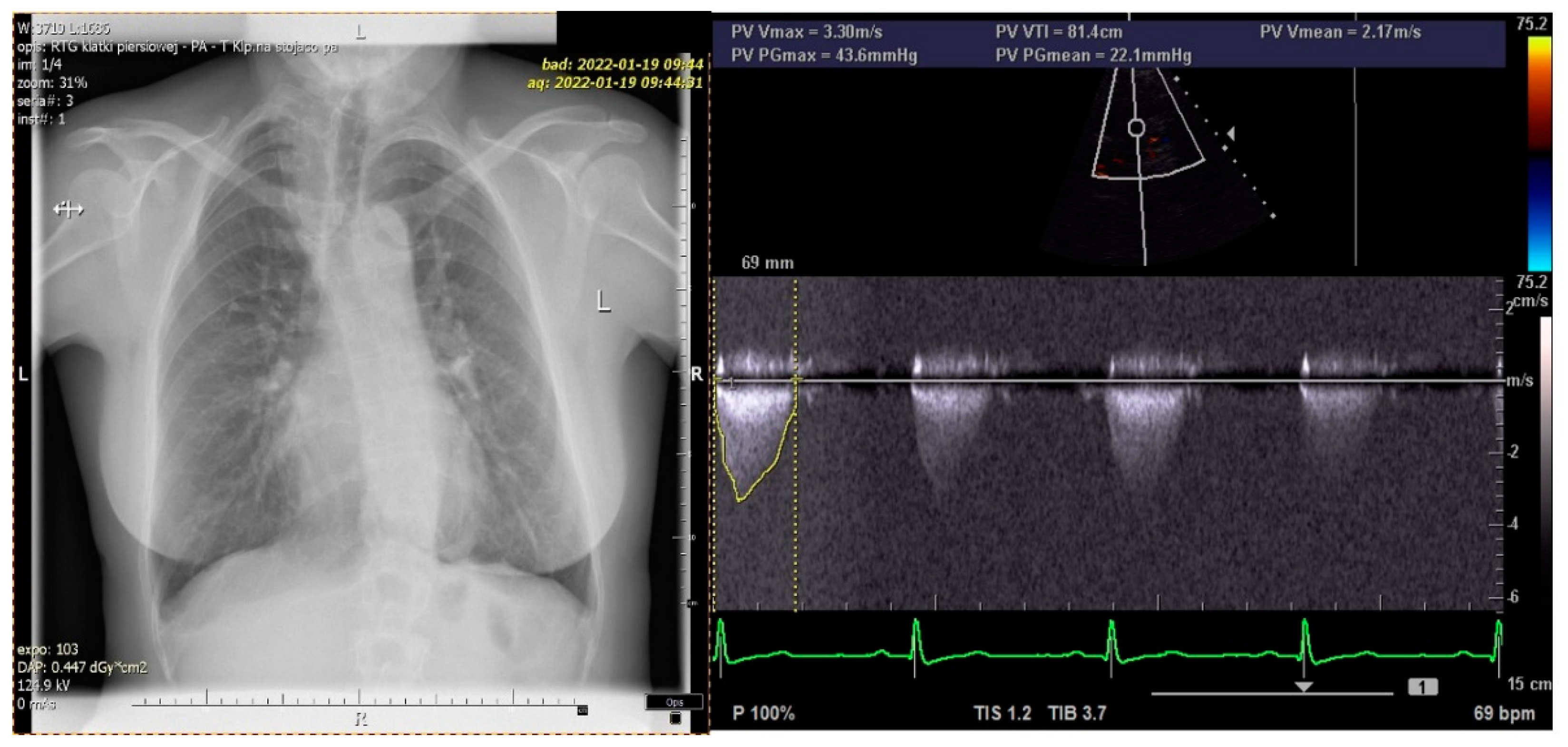Diagnostics 12 00569 g005