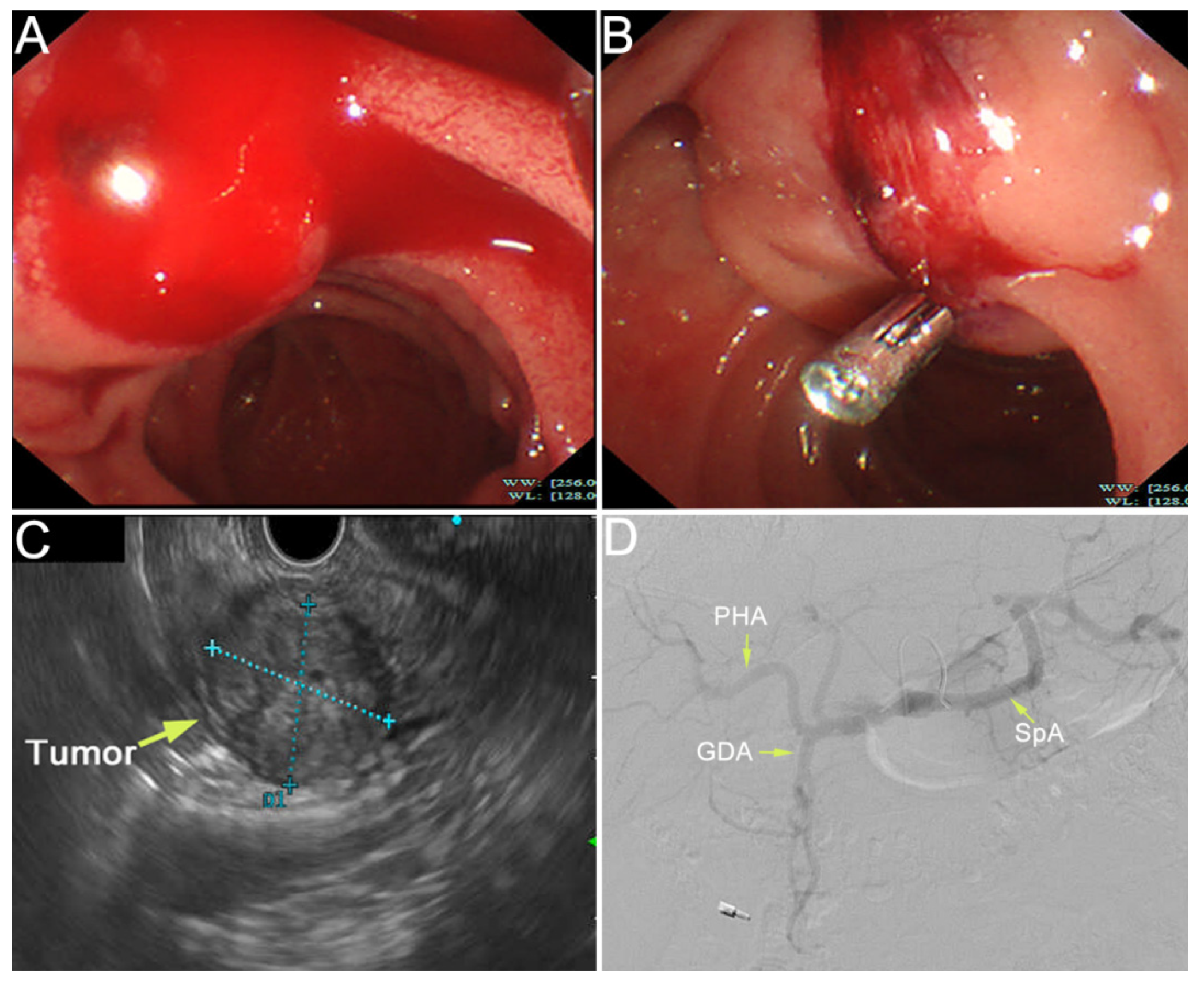 Diagnostics 12 00571 g002