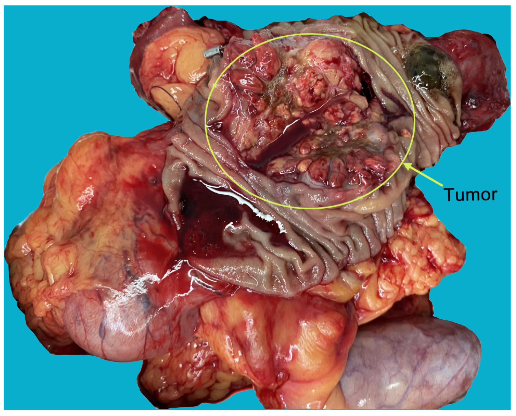 Diagnostics 12 00571 g003